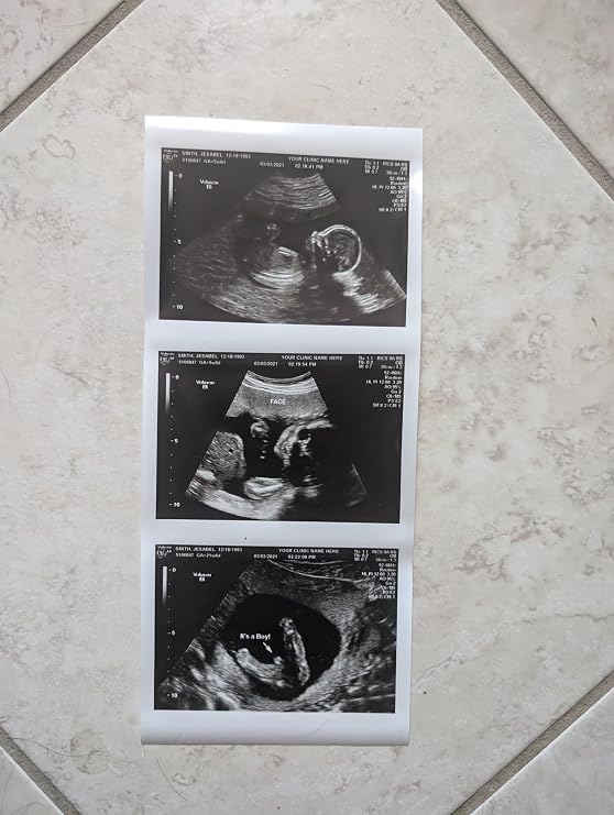 Prank 2D Customized Fake Ultrasound Strip of 3 Photos