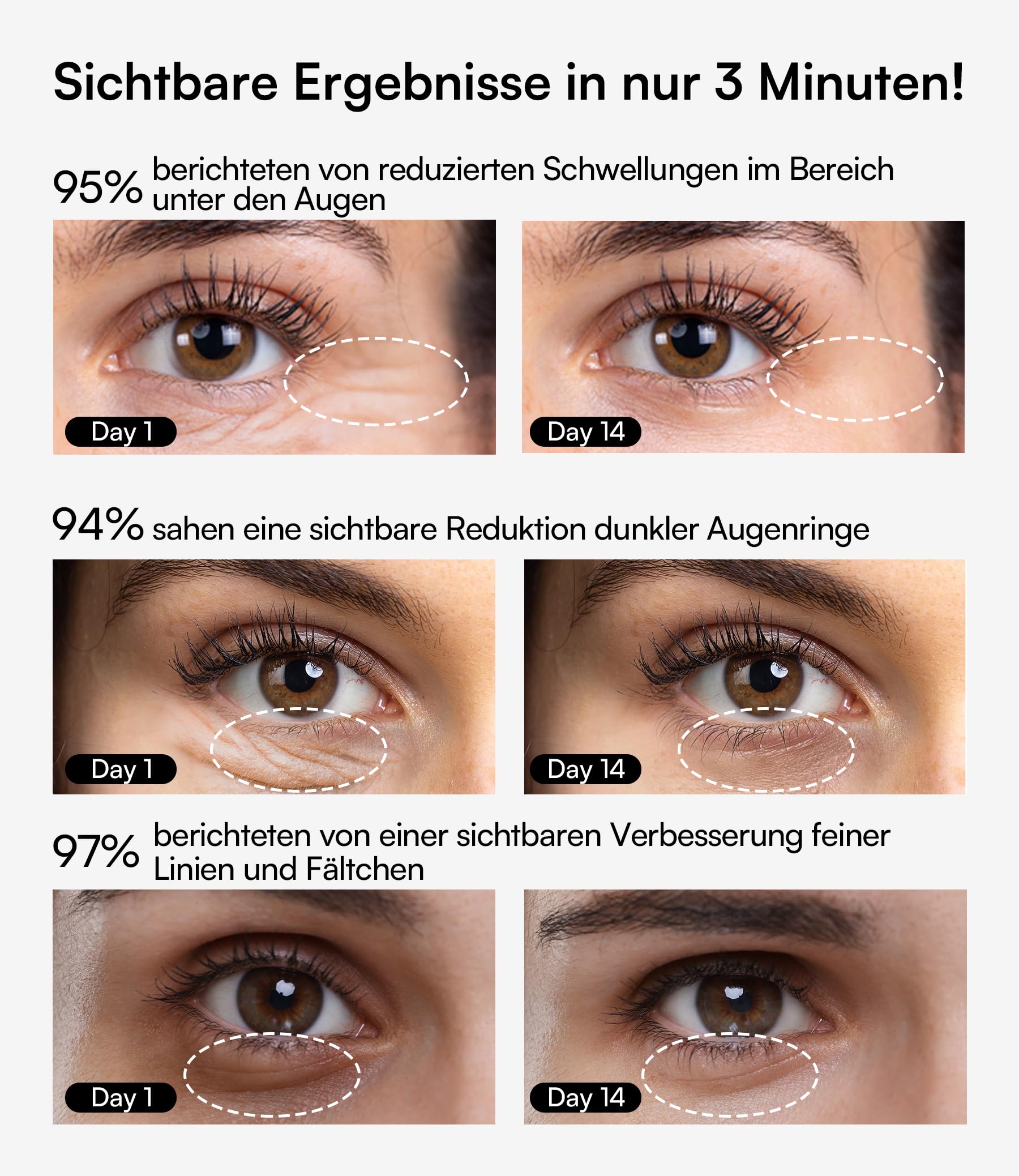 INIA Augenmassagegerät gegen Augenringe & Tränensäcke, EMS Gesichtsmassagegerät mit Rotlicht & Wärme, Anti-Aging Face Massager zur hautstraffung, Schwellungen & Fältchen entfernen–Tragbar, 3 Modi