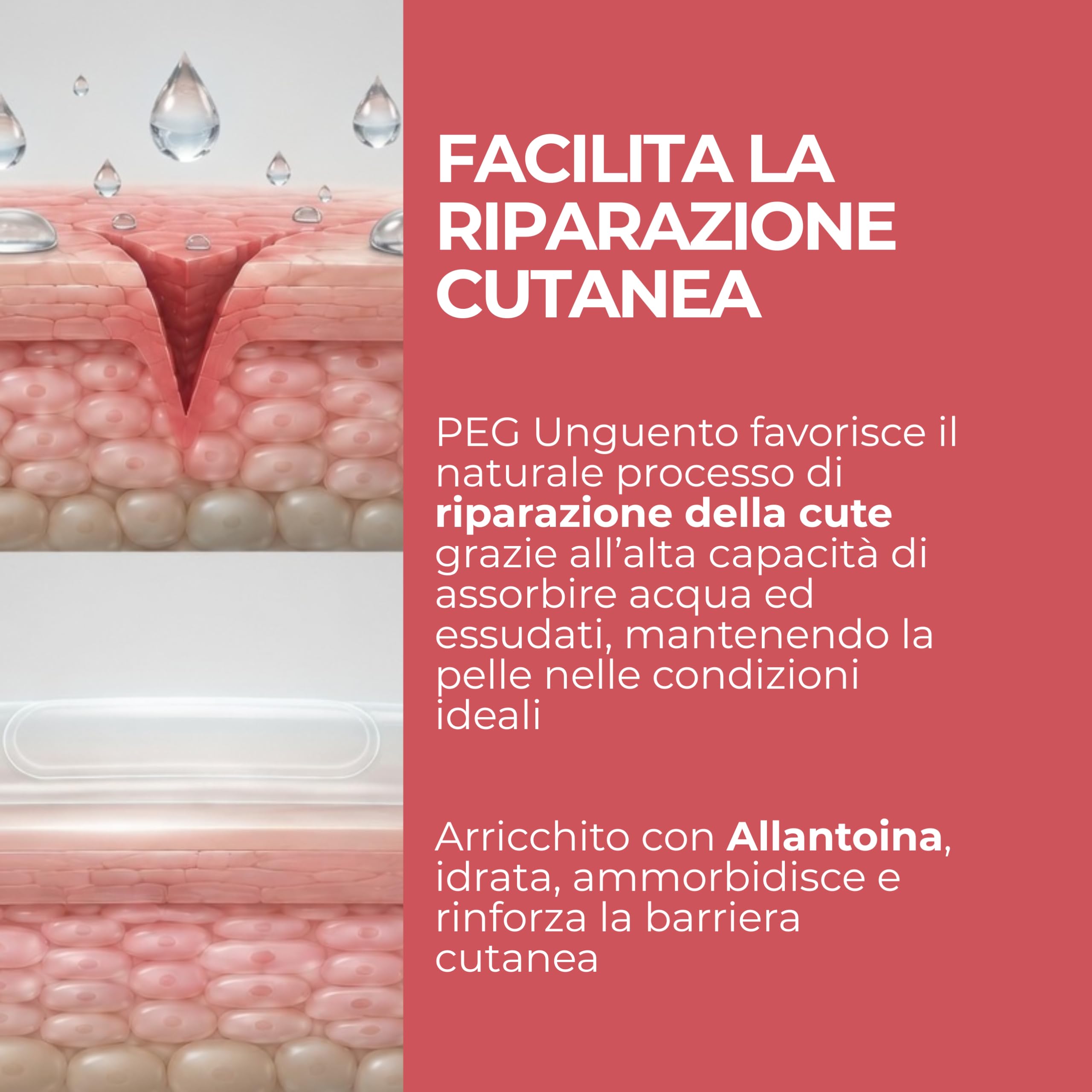 MOST - PEG Unguento Viso e Corpo Bambini e Adulti Lenitivo e Protettivo, Diminuisce Rossori e Stimola Processi di Riparazione Cutanea in Ragadi, Scottature Lievi, Cicatrici, Dermatite Atopica, 100 ml