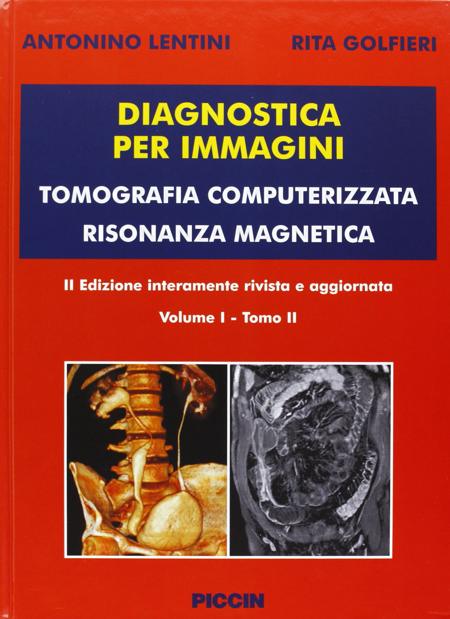 Diagnostica per immagini vol. 1/1 e 1/2. Tomografia computerizzata risonanza magnetica