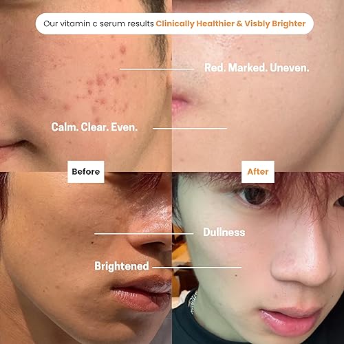 Miniatura 2 de Puréel - Suero con 20% de vitamina C para la cara, suero iluminador con vitamina E y ácido ferúlico, antienvejecimiento, removedor de manchas