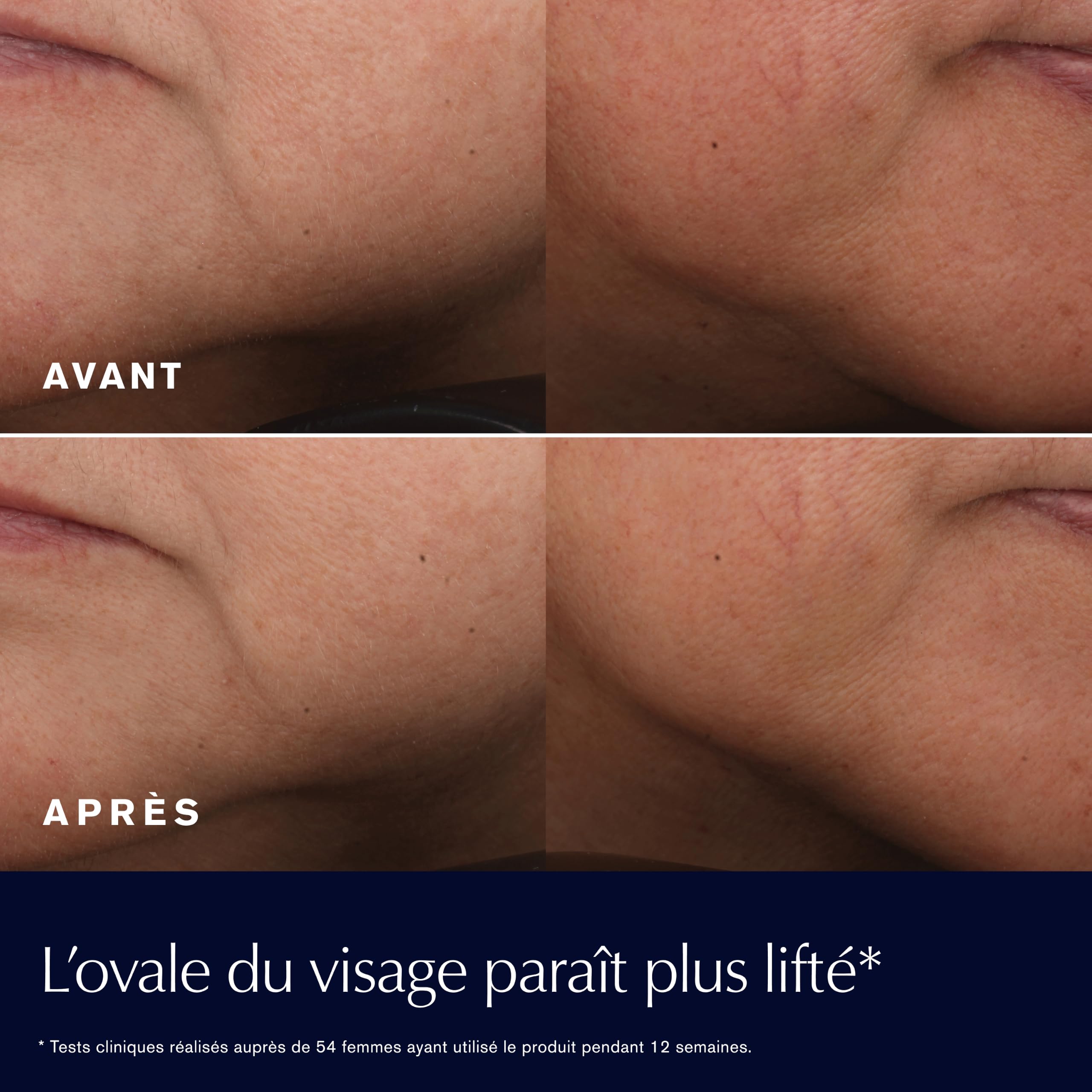 Estée Lauder Revitalizing Supreme+ Crème Révélatrice de Jeunesse Anti-Âge | Crème Hydratante Visage Multi-Action | Raffermit, Lifte et Donne de l'Éclat, 50ml