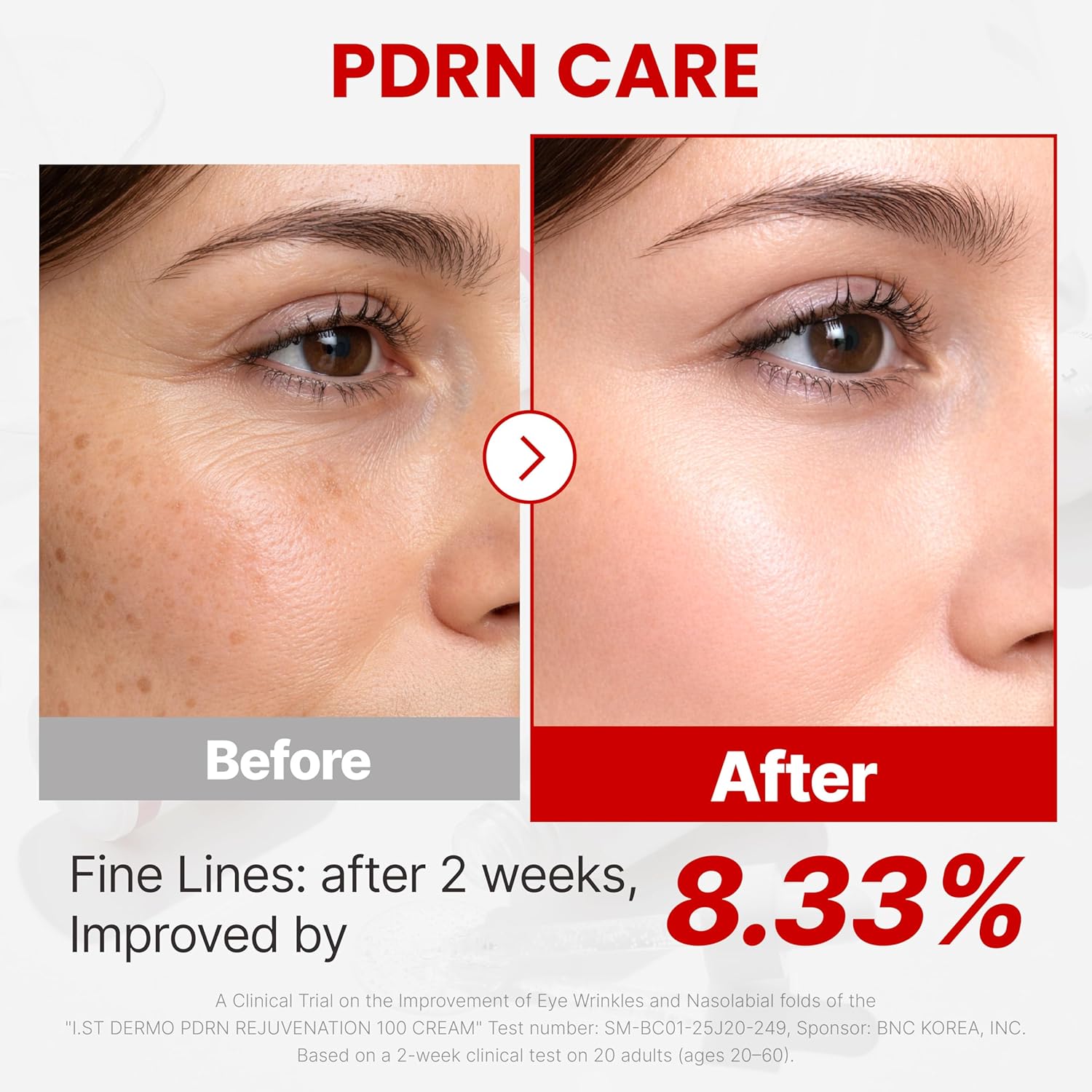 I.st Dermo PDRN 100 Cream, Korean Face Ceramide Moisturizer for Women, Peptide Barrier Radiant Cream for Sensitive Skin, Soothing Facial Cream for Dry, Sensitive Skin, 1.69 Fl Oz
