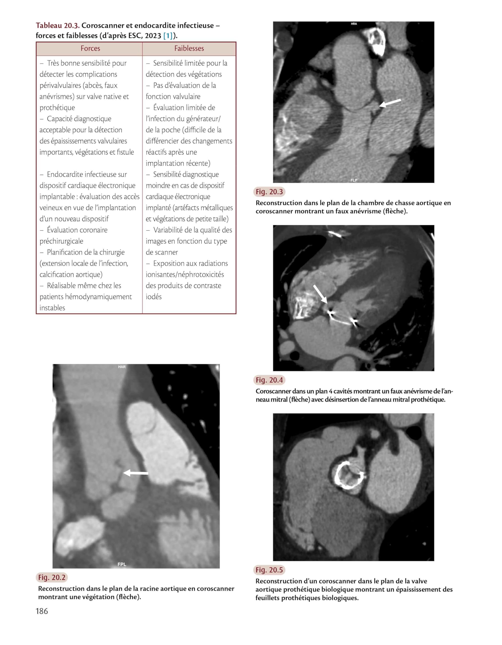 Radiologie cardiaque