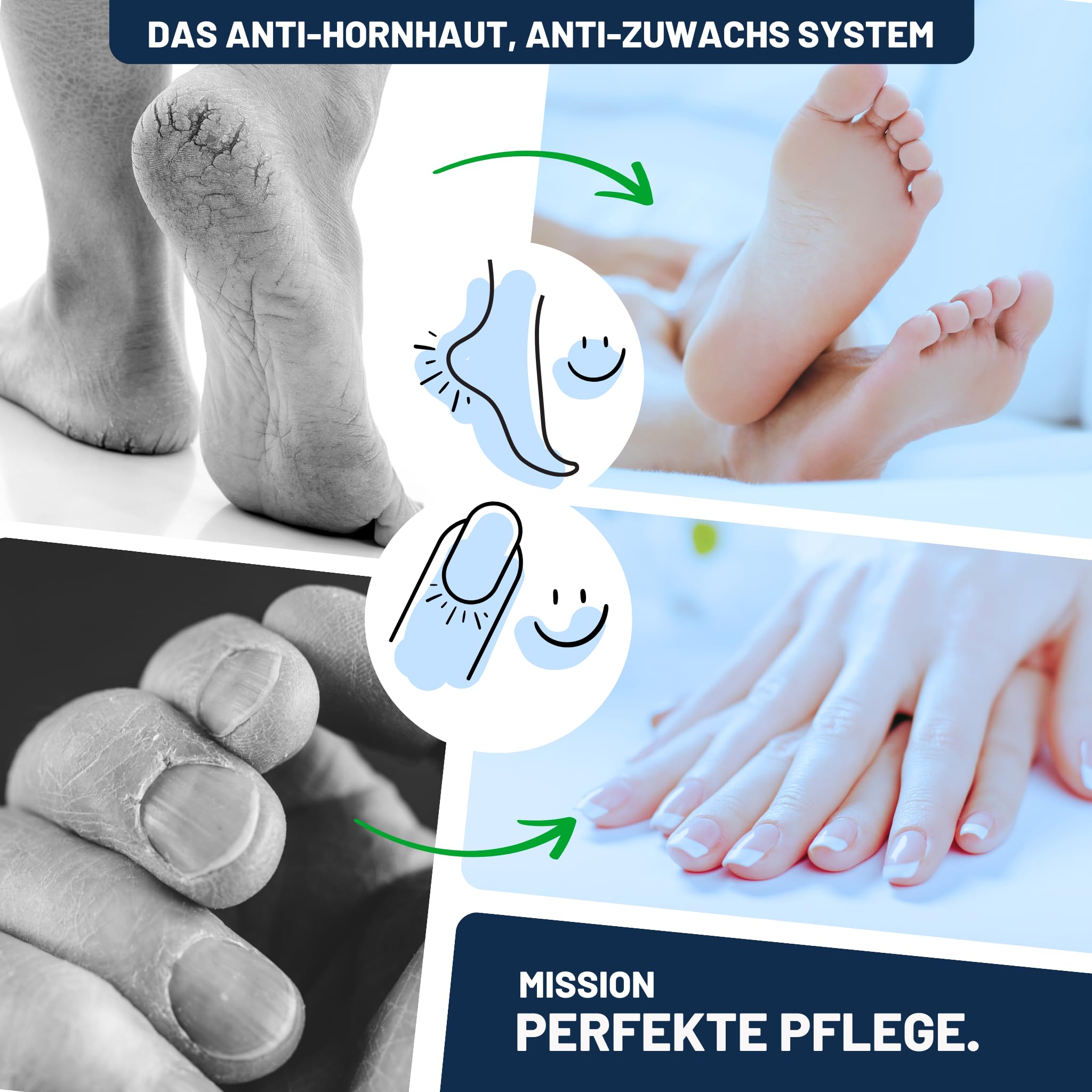 Mr. Fuss® Anti-Callus, Regrowth System - Środek do usuwania martwego naskórka - Rozwiązanie nr 1 - silnie zmiękcza