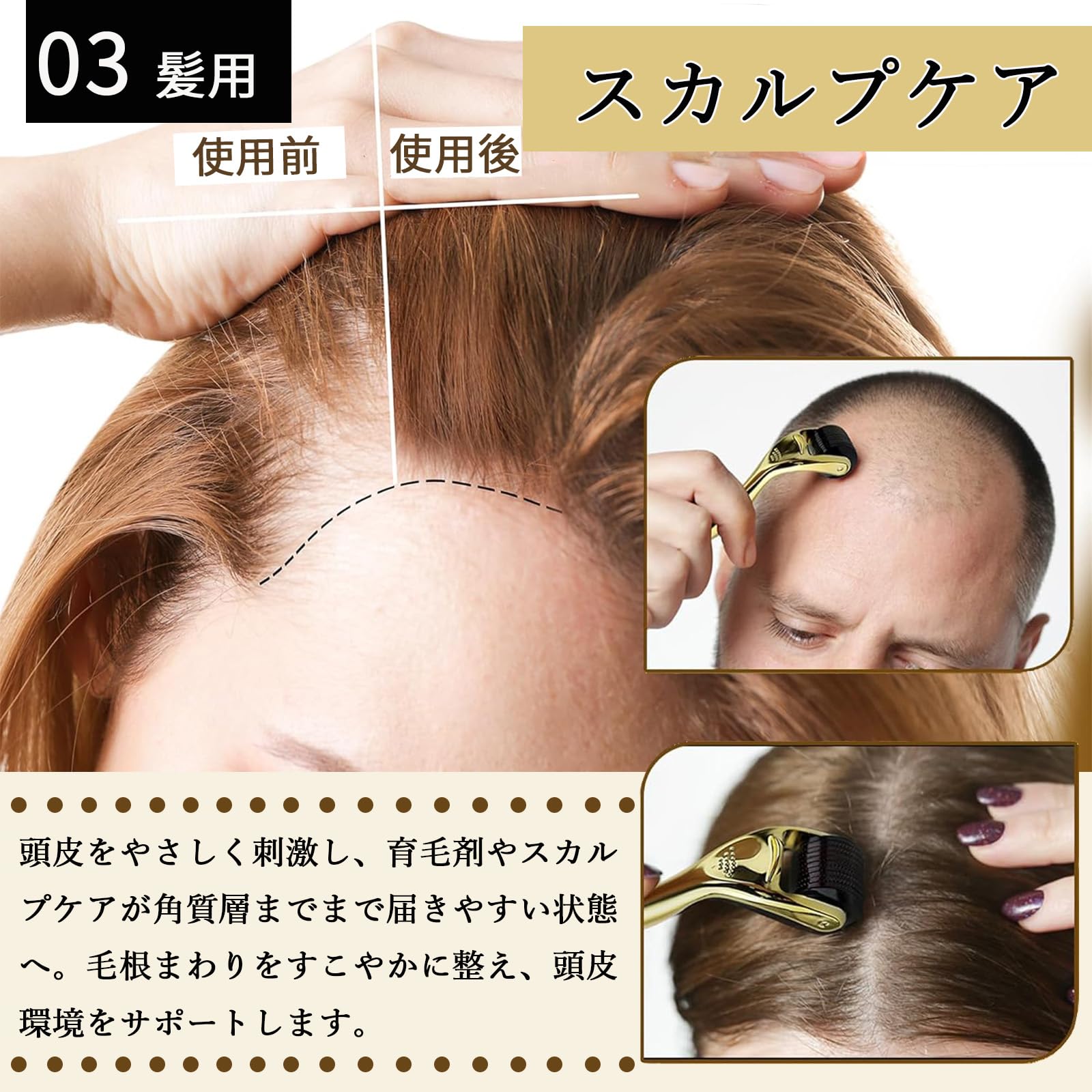 Amazon | SrDiot ダーマローラー 1.0mm マイクロニードルローラー 美顔