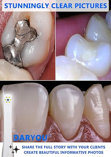 Miniatura 2 de Cámara dental intraoral DARYOU DY-50 super clara alta calidad funciona con la mayoría de software de imagen