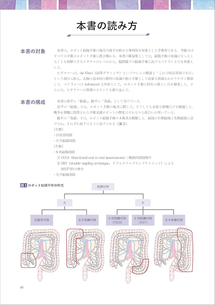 一人で難なくこなすための ロボット支援下結腸手術［Web動画付