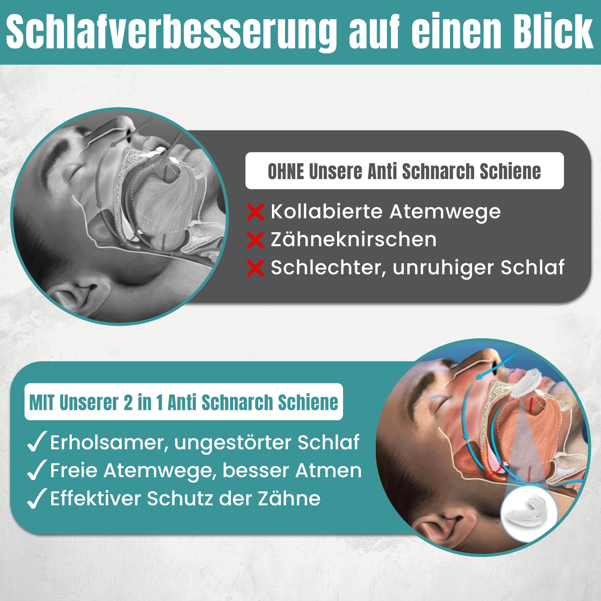 2-in-1 Anti Schnarch Schiene Gerät – Schnarchstopper Knirscherschiene für Nacht | Schnarchschiene Zahnschutz | Schnarchen Stopper Zahnschiene Knirschen | Aufbissschiene für Nacht Gegen Schnarchen