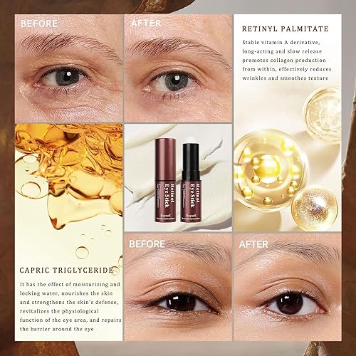 Miniatura 2 de Barra de ojos con retinol, crema de ojos con retinol para ojeras e hinchazón, arrugas en 3-4 semanas, crema para debajo de los ojos