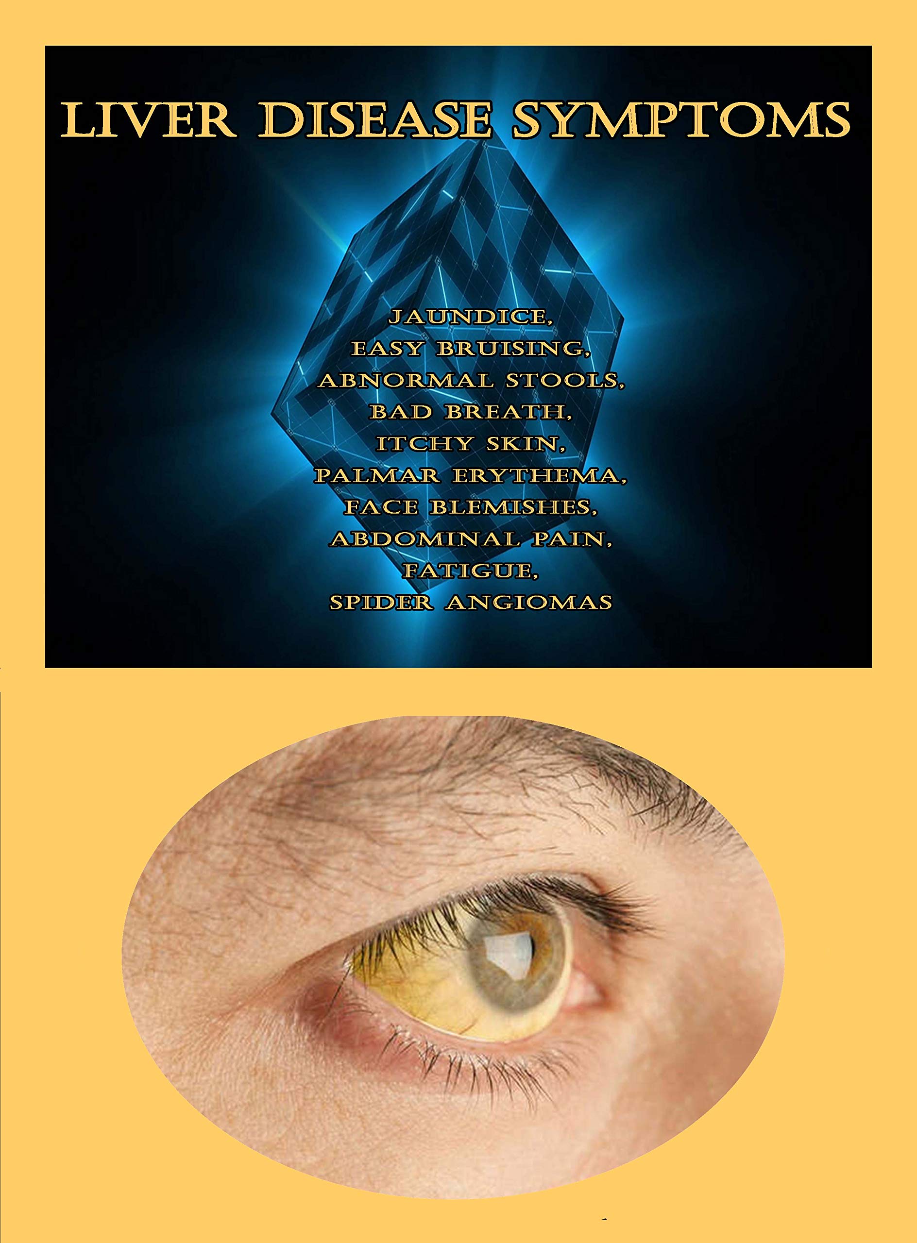 Buy Liver Disease Symptoms Jaundice, Easy Bruising, Abnormal Stools