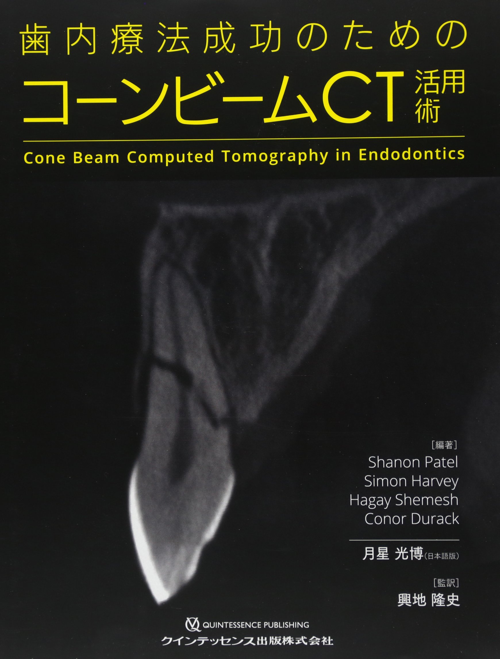 【裁断済み】歯内療法成功のためのコーンビームＣＴ活用術 歯内療法成功のためのコーンビームCT活用術 | Shanon Patel, Simon