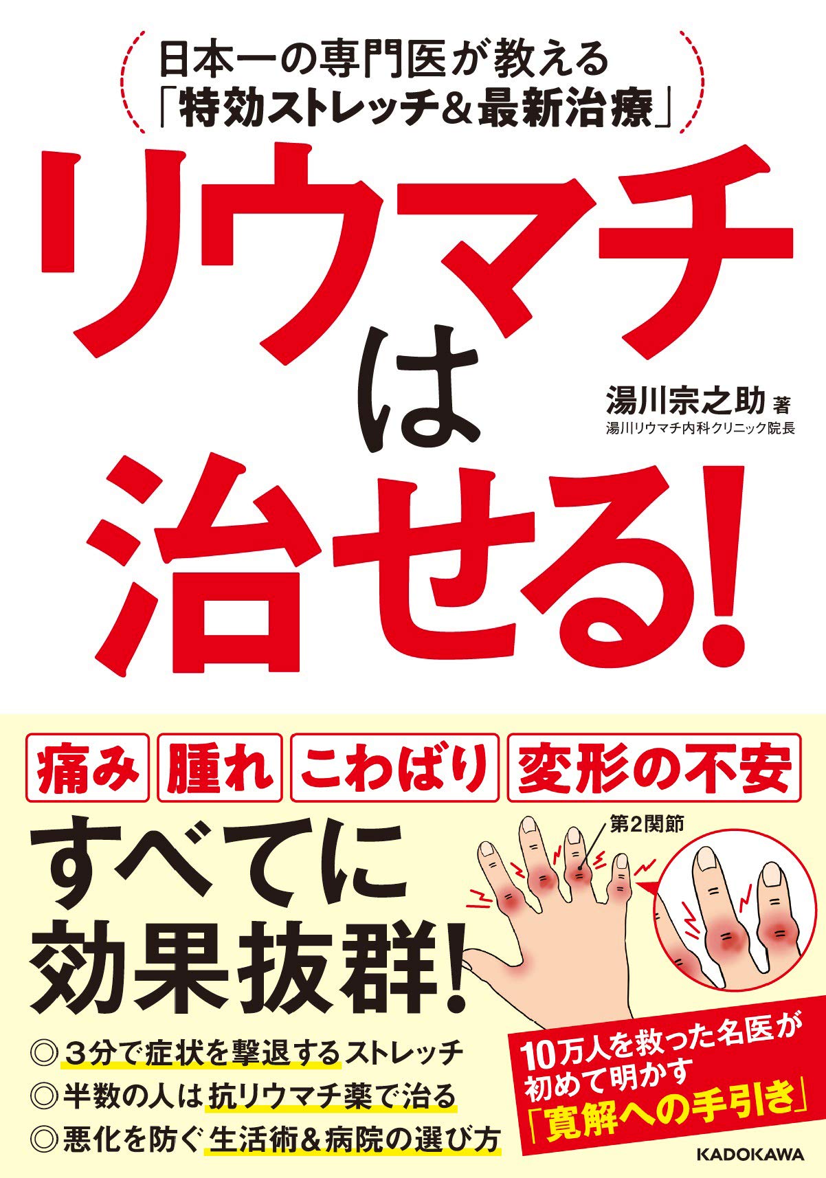 リウマチ治療専門書5冊セット リウマチは治せる! 日本一の専門医が教える「特効ストレッチ&最新治療