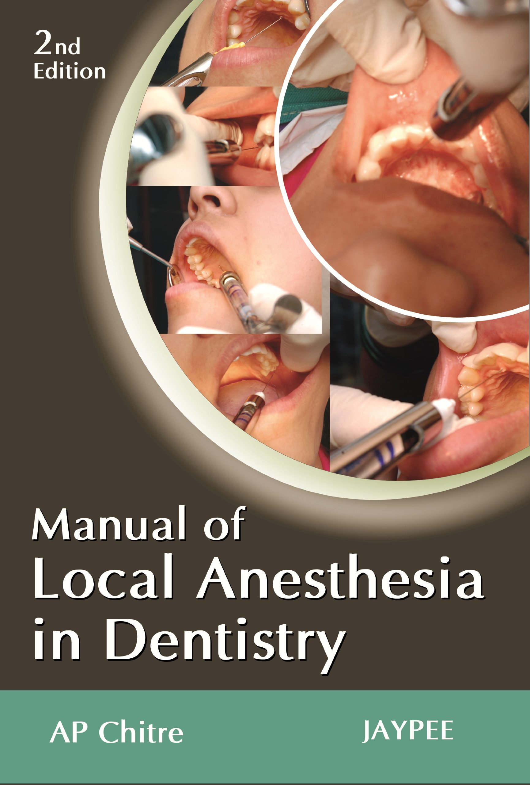 Manual of Local Anaesthesia in Dentistry