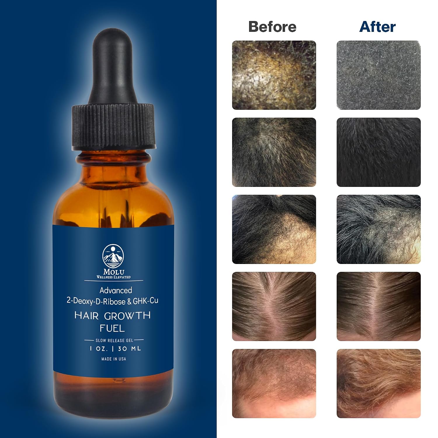 Molu Peptide Advanced Hair Growth Serum, Supporting Thicker, Fuller Hair | with GHK-Cu Copper Peptide, 2-Deoxy-D-Ribose, Sodium Lactate, Caffeine, and Korean Ginseng – 1 oz
