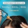 Head and Shoulders Scalp Cream Treatment, Daily Moisture, Anti Dandruff, Royal Oils Collection with Coconut Oil, Scalp Care for Natural and Curly Hair, 5.0 fl oz