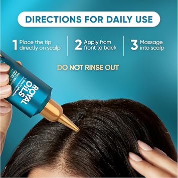 Head and Shoulders Scalp Cream Treatment, Daily Moisture, Anti Dandruff, Royal Oils Collection with Coconut Oil, Scalp Care for Natural and Curly Hair, 5.0 fl oz