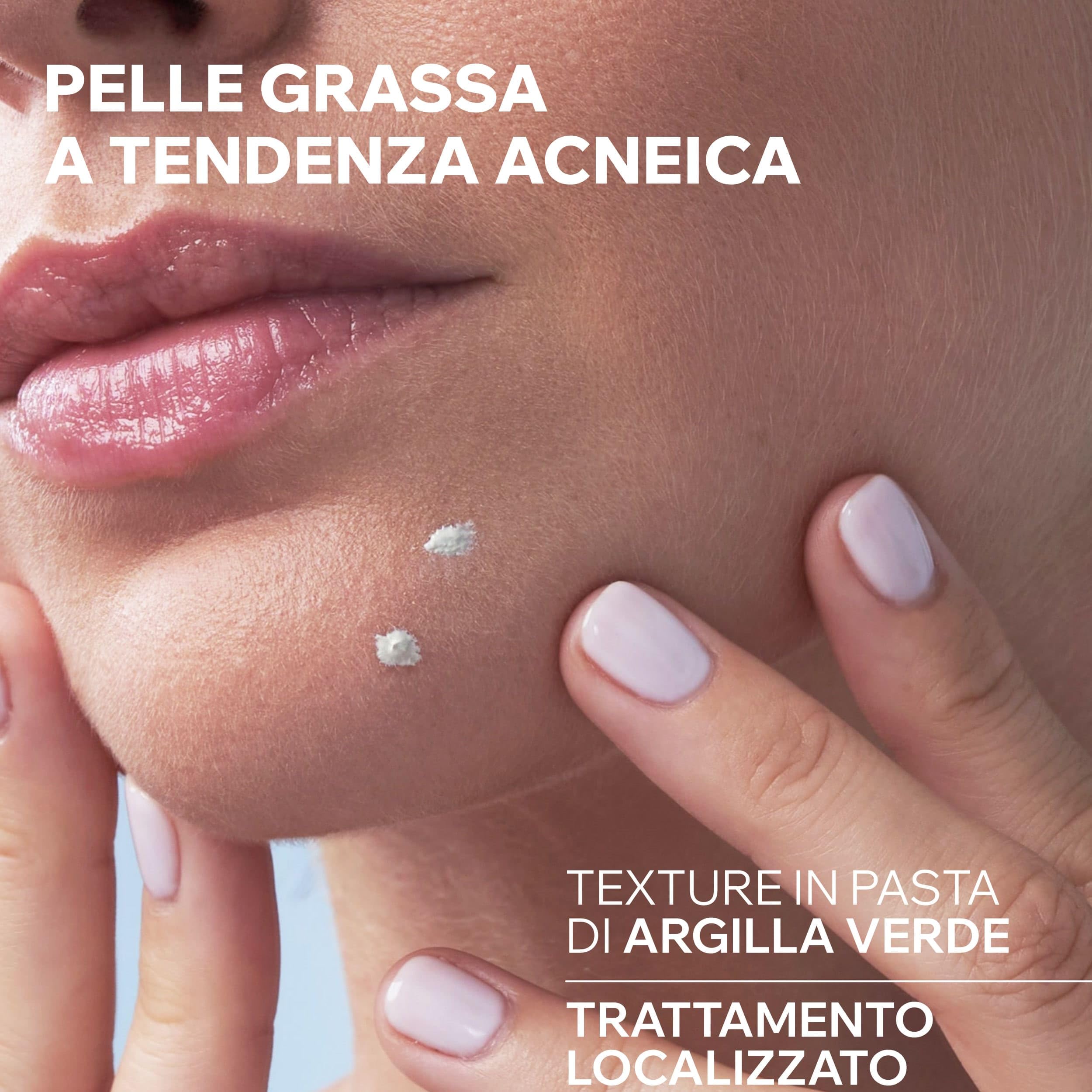 Uriage Hyseac Pasta SOS con Árbol del Té, Zinc y Arcilla Verde - Acelera la Maduración de las Imperfecciones de la Noche a la Mañana y Limita las Marcas en la Piel - Para Granos e imperfecciones.