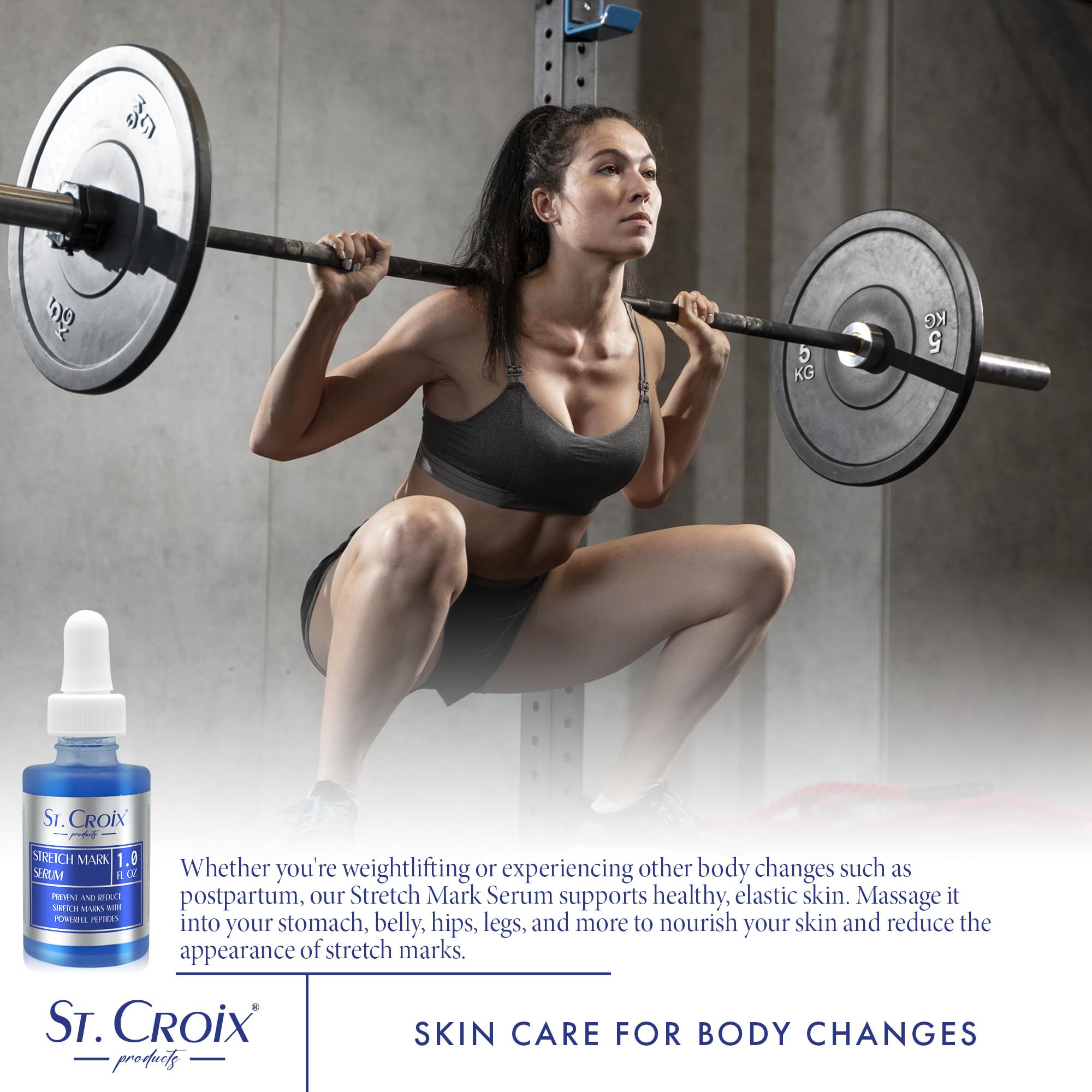 Amazon.com : Stretch Mark Serum - Prevent and Reduce Appearance of