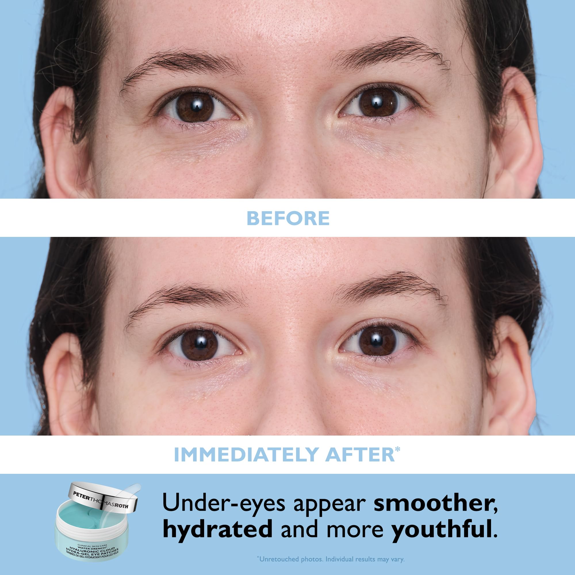 Peter Thomas Roth | Full-Size Water Drench® Essentials 2-Piece Face & Eye Kit | Hyaluronic Acid Skincare Set, Moisturizer and Eye Masks