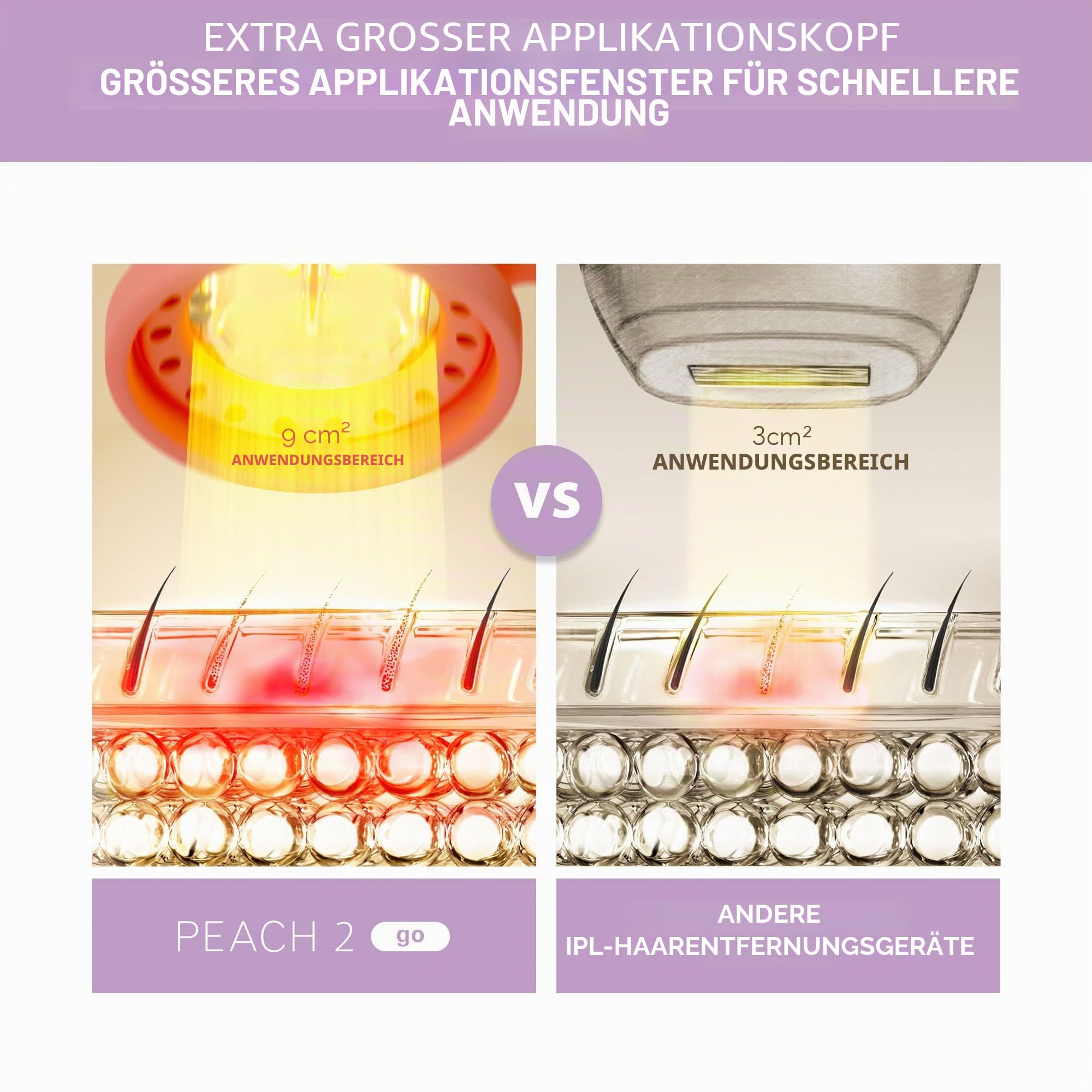 FOREO Fuzz-free Peach 2 go Set Epilierer mit pulsiertem Licht permanente Haarentfernung Gesicht Körper