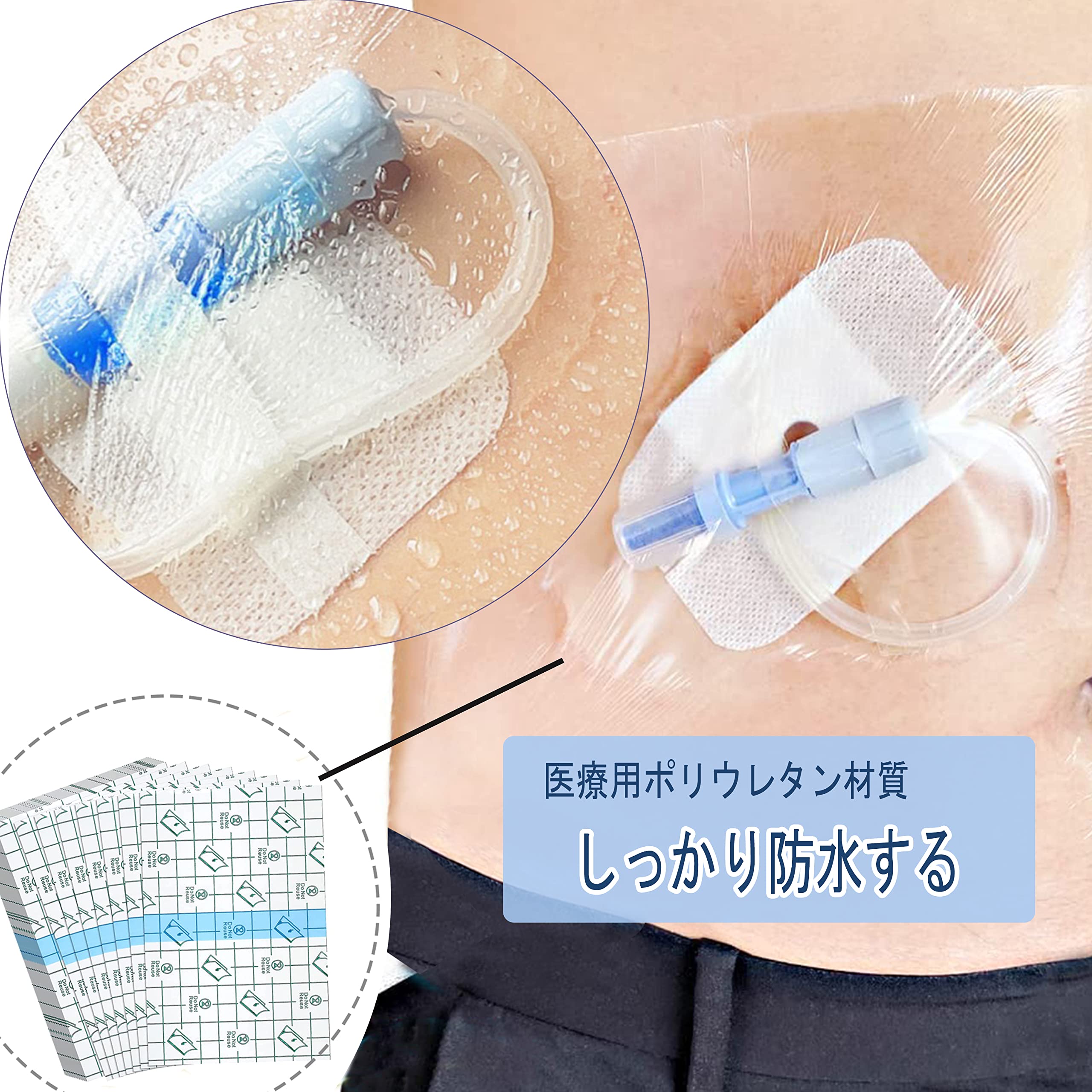 Amazon | 腹膜透析防水フィルム 装具とキズ口に防水 PDカテーテル防水