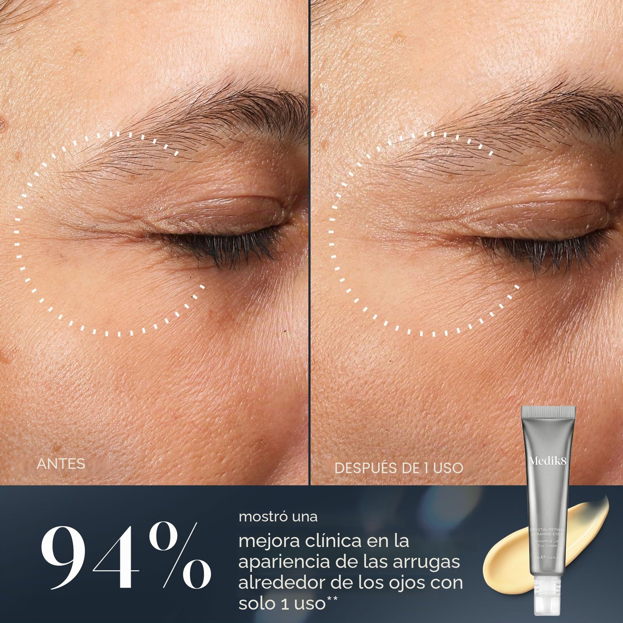Medik8 Crystal Retinal Ceramide 10 - Crema para ojos antienvejecimiento y antiarrugas, suave y elevadora, 0,10% de fuerza retiniana, 11 veces más rápida que el retinol, para usuarios avanzados de