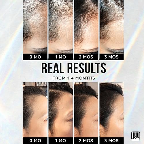 Miniatura 8 de Renovo Biotin - Suero para el crecimiento del cabello, 1 onza líquida, suero de biotina para el crecimiento del cabello para mujeres, sin fragancia,