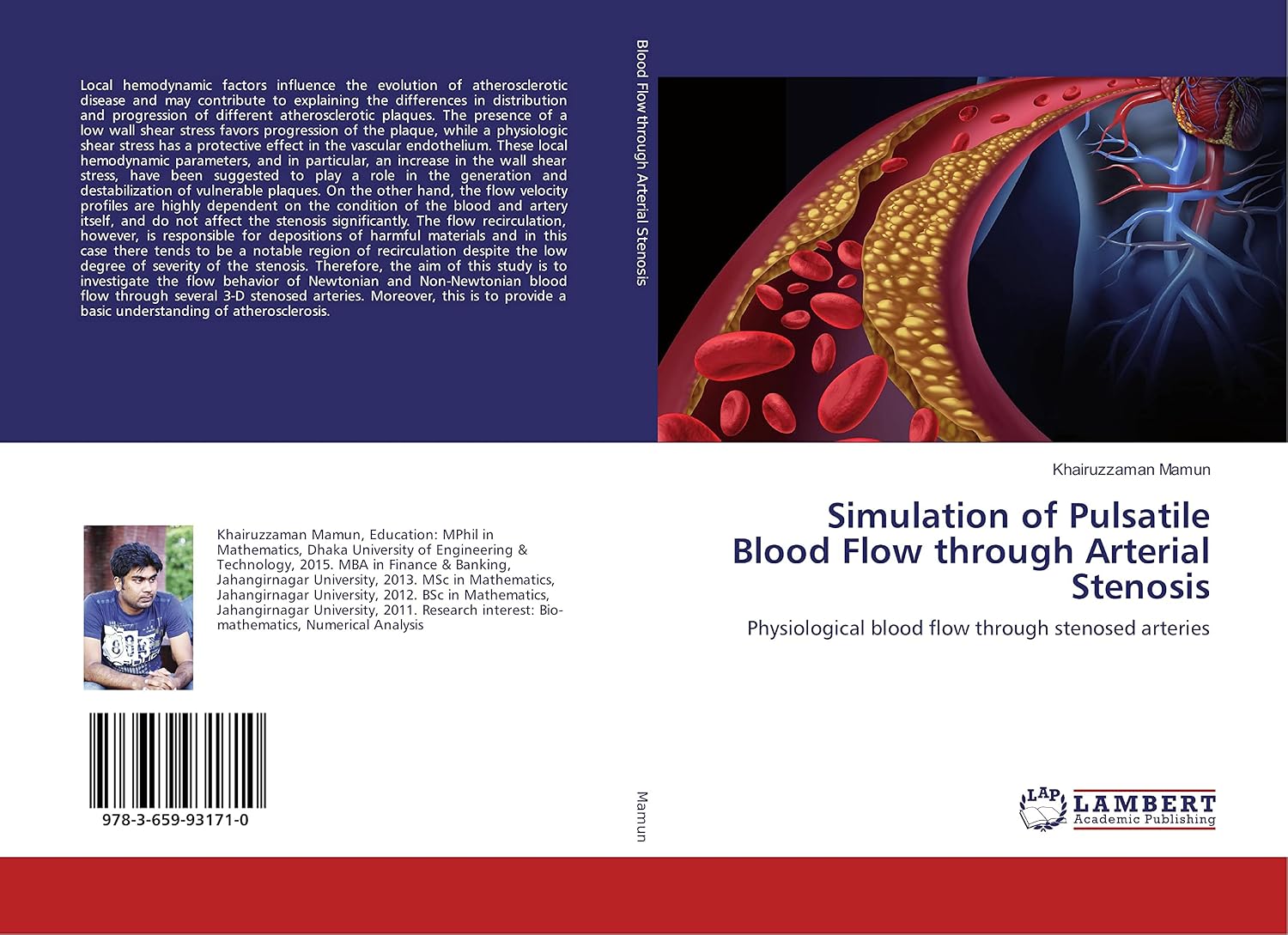 Simulation of Pulsatile Blood Flow through Arterial Stenosis ...