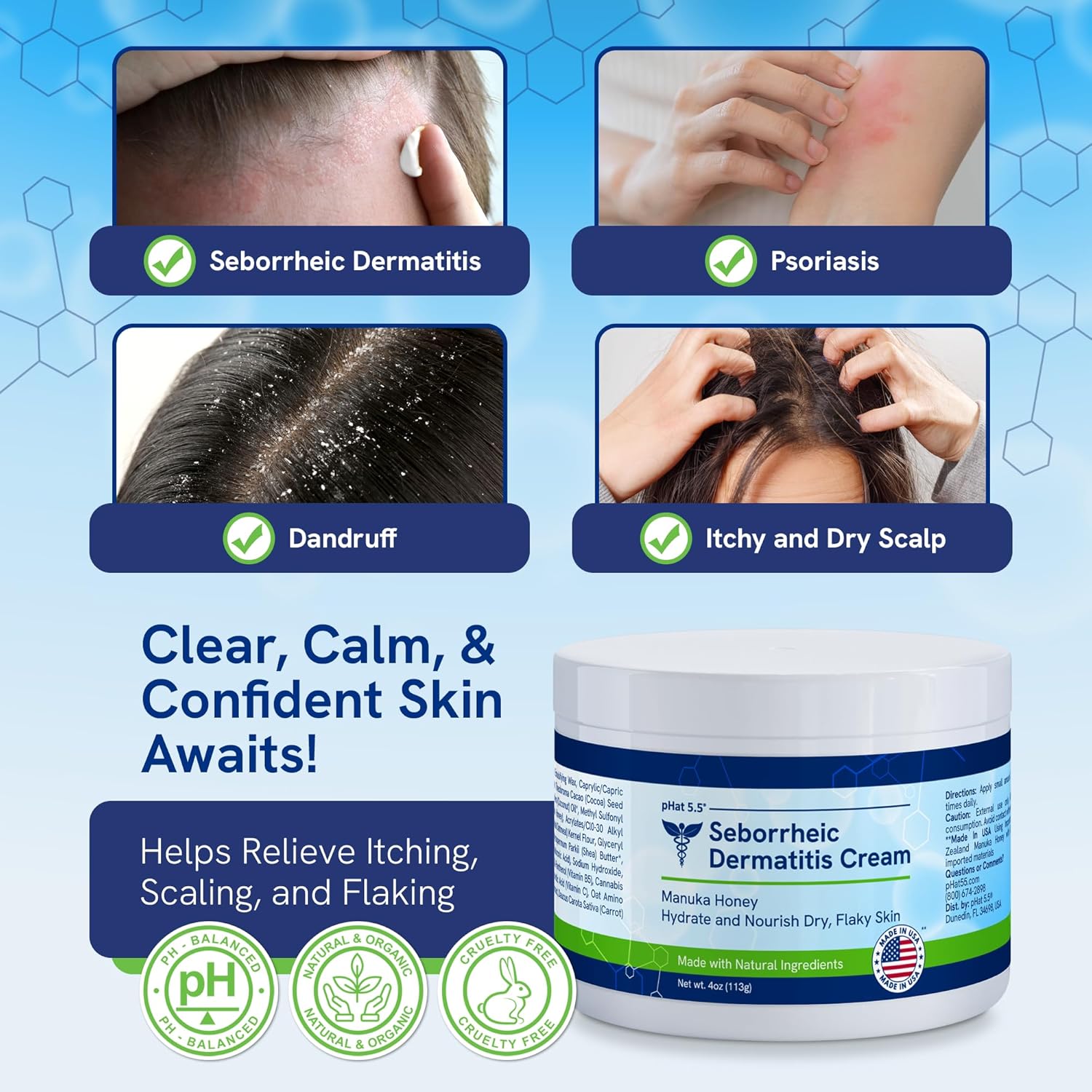 pHat 5.5 Itch Cream for Itchy Skin Relief - Moisturizing Cream & Face Lotion for Women - Redness Relief for Face & Body - For Dry Skin & Itchy Scalp - Anti Itch Lotion (4oz)