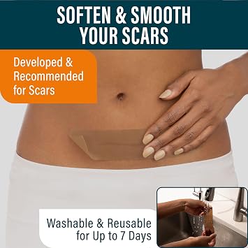 NUVADERMIS Silicone Scar Sheets & Scar Cream Gel - C-Section, Tummy Tuck, Keloid, Acne Removal Treatment - Advanced Post Surgery Supplies - Scars Removal Treatment