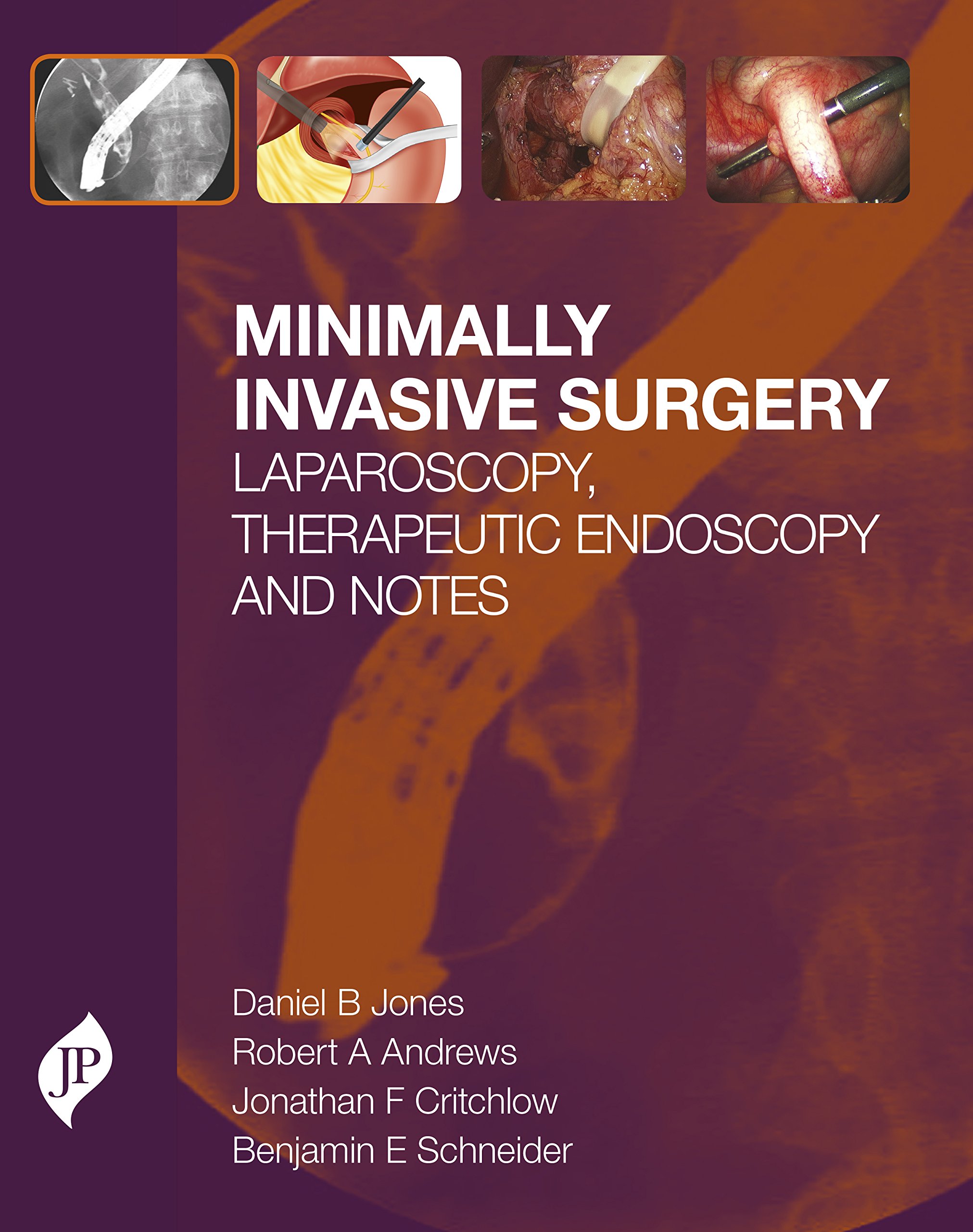 Minimally Invasive Surgery: Laparoscopy, Therapeutic Endoscopy and ...