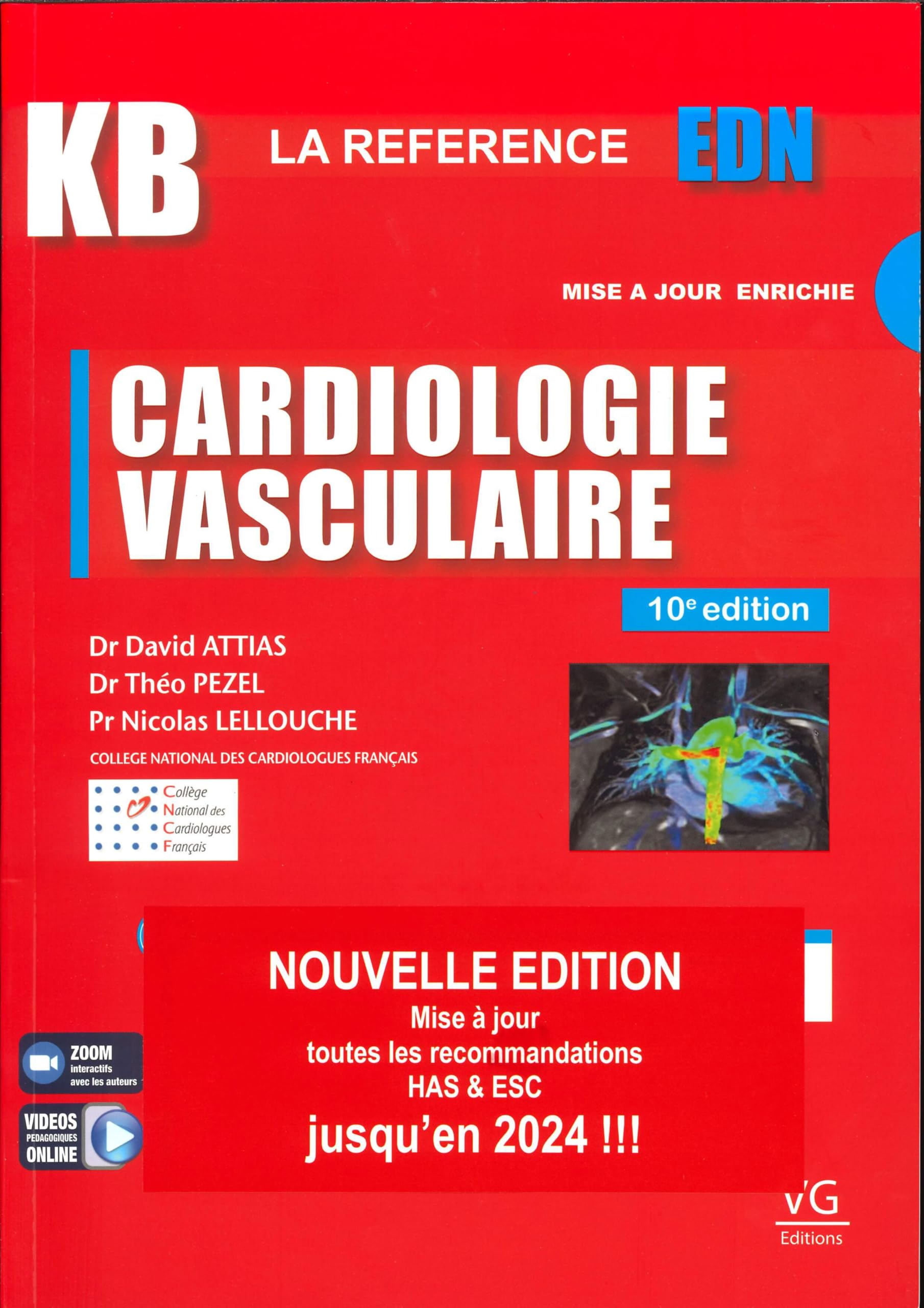 Cardiologie vasculaire: Pack en 2 volumes avec livret de fiches