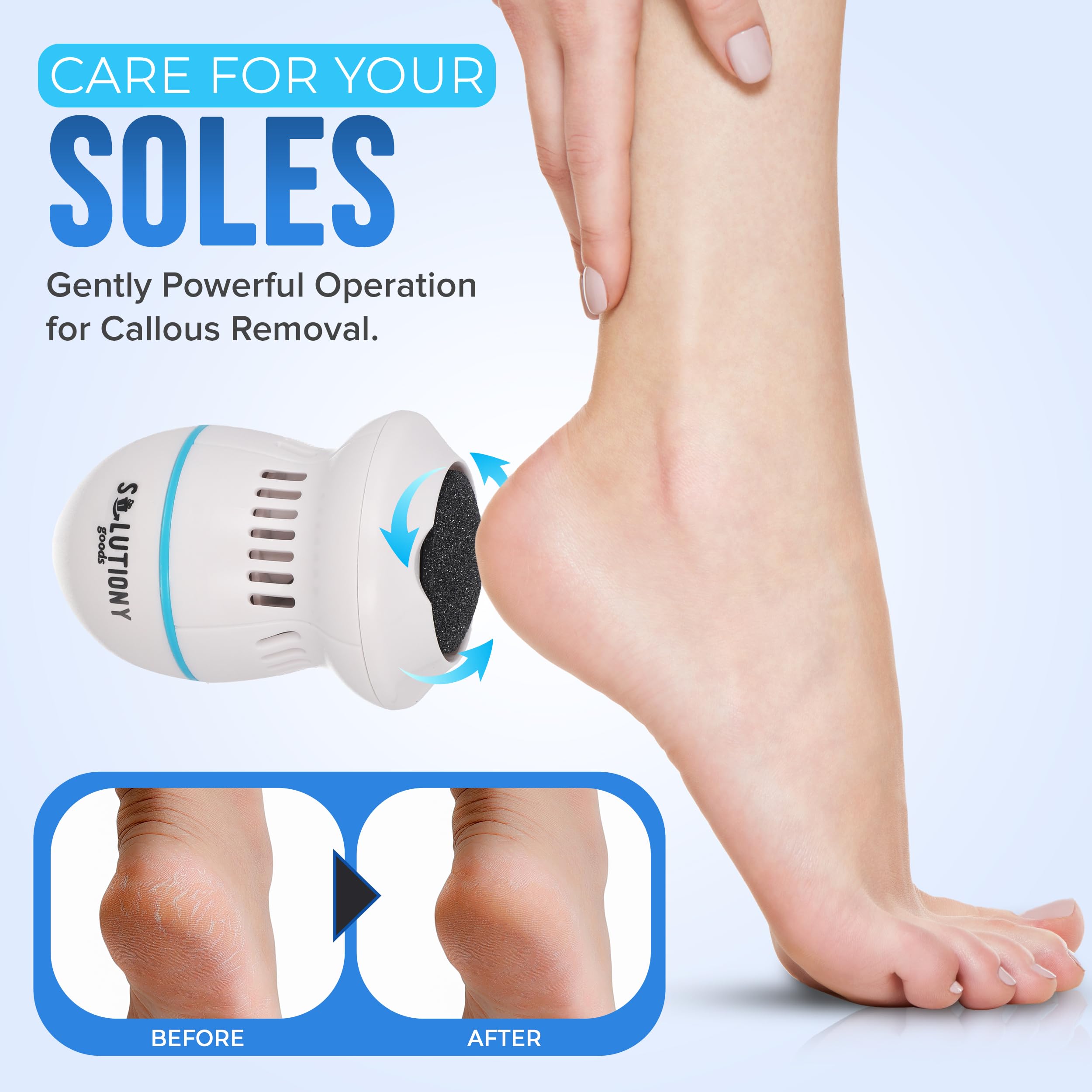 Electric Foot Callus Remover - USB-Rechargeable With Built-in