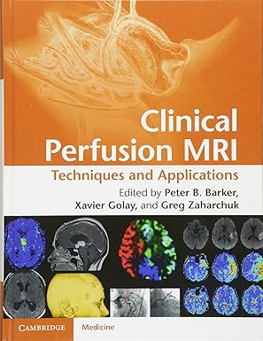 Clinical Perfusion MRI: Techniques and Applications-Wow! eBook