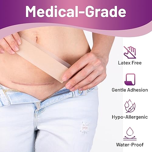 Miniatura 3 de ChicDerma Cinta de silicona para cicatrices de 1.6 x 120 pulgadas, hojas de silicona para cicatrices quirúrgicas, tiras de silicona suave de grado