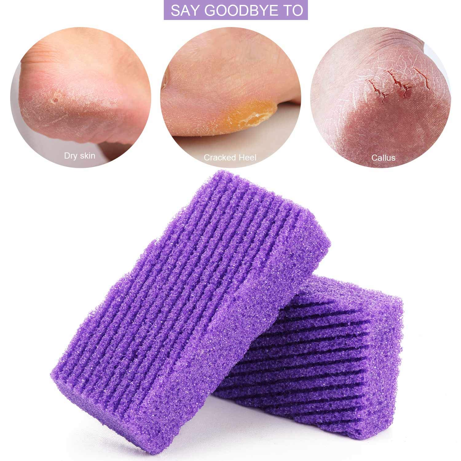 6 pcs Foot Pumice Stone Pad, Exfoliating Sponge to Scrub Hard Dead Skin, Callus removal