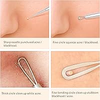 Vista 6 de Removedor de puntos negros con cámara, WiFi Visual Blackhead Remover Herramientas con luces blancas/azules para iPhone, teléfonos Android, regalo