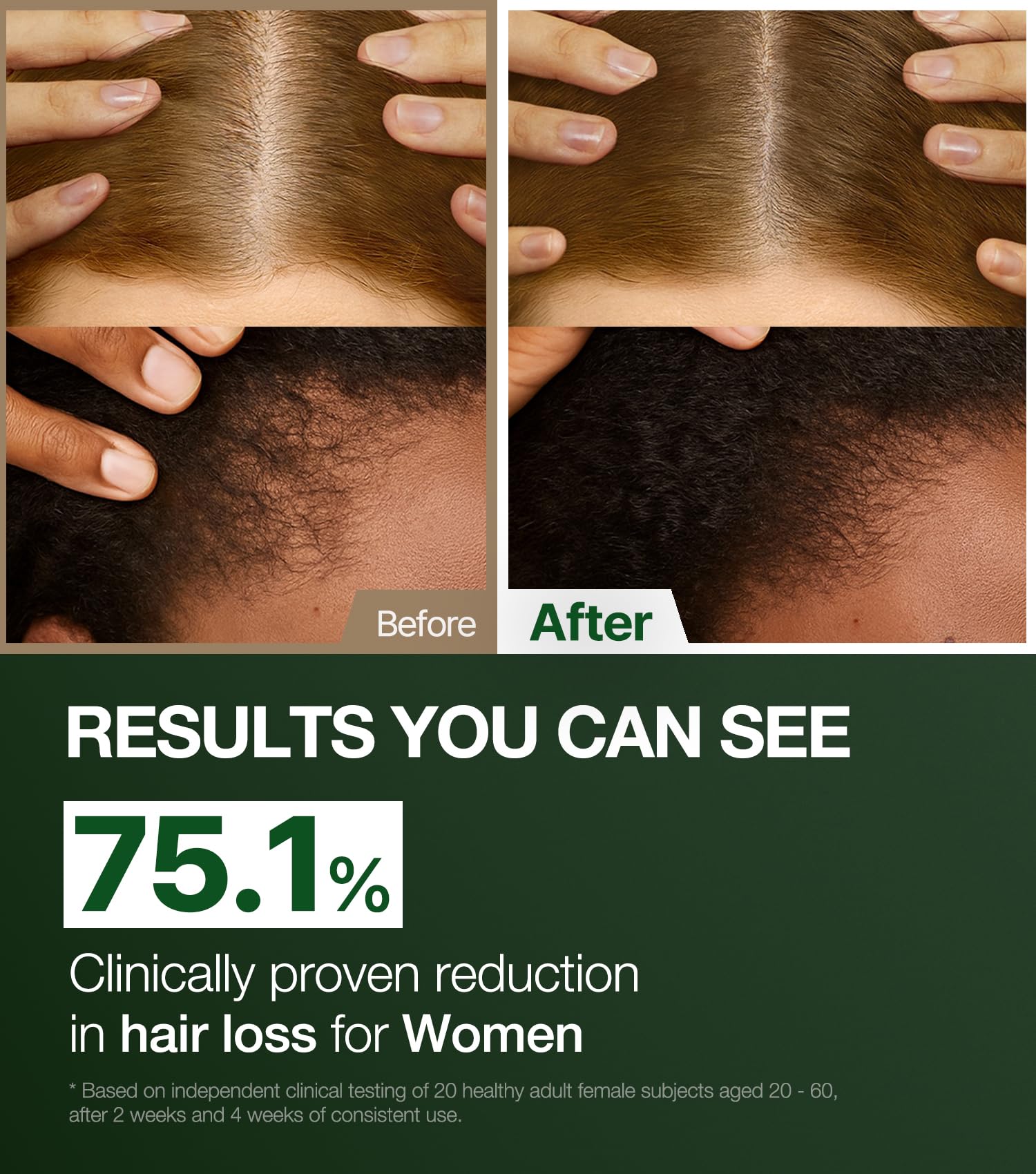 Alpha Erguen Hair Loss Shampoo for Women, Vegan Scalp Care, 500ml
