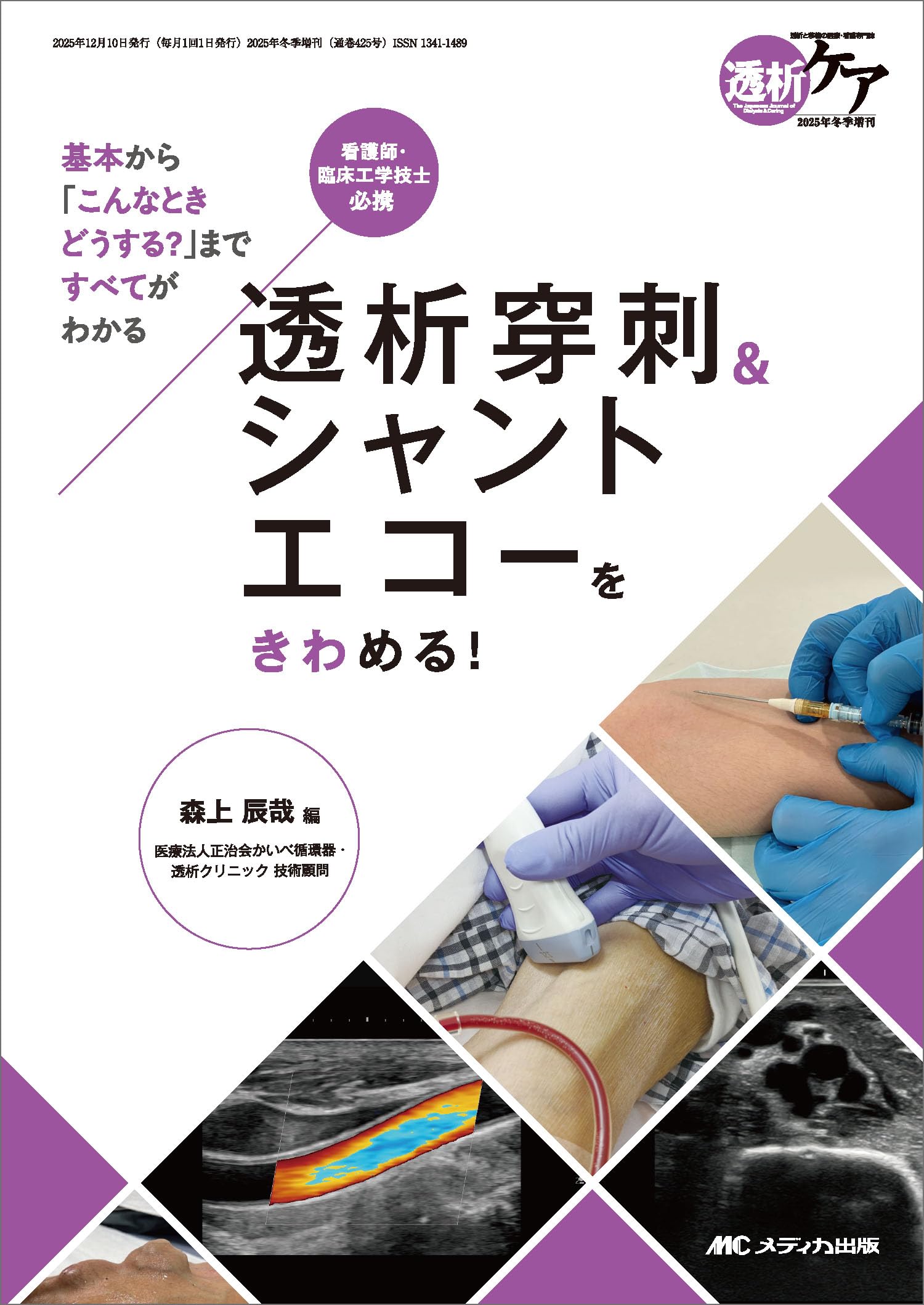 透析穿刺＆シャントエコーをきわめる！：基本から「こんなときどうする