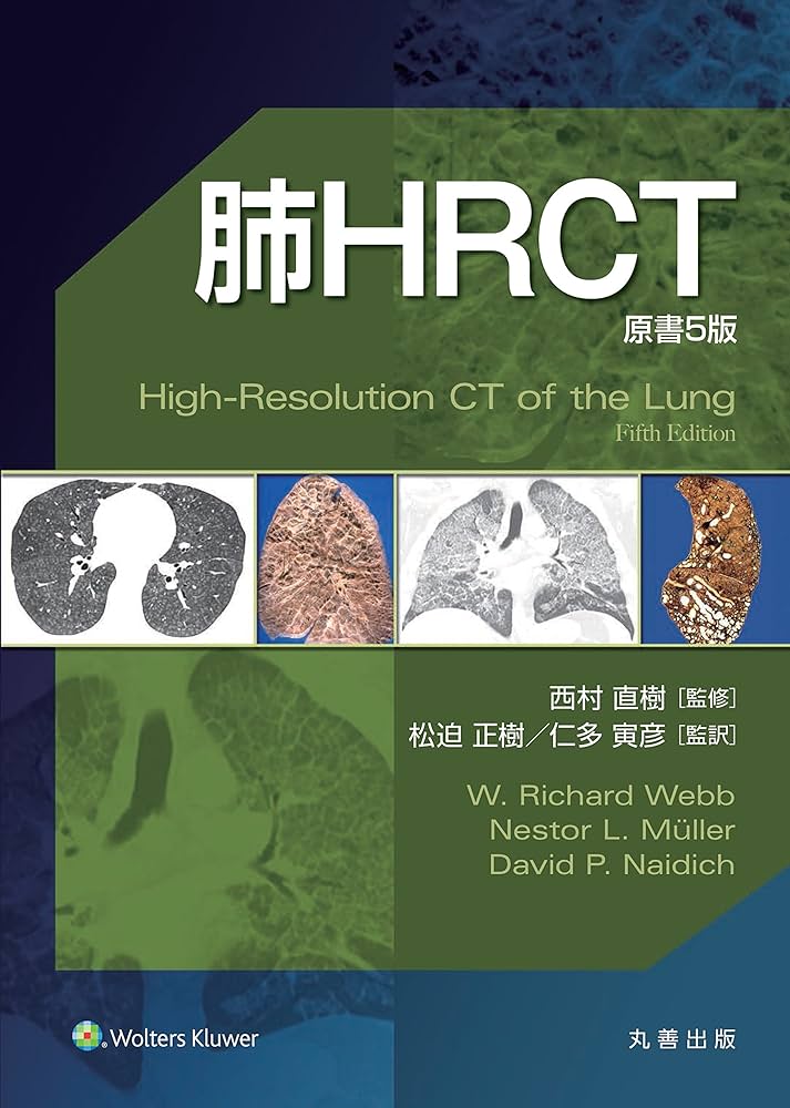 Amazon.co.jp: 肺HRCT 原書5版 : 西村 直樹, 松迫 正樹, 仁多