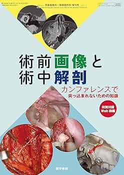 耳鼻咽喉科・頭頸部外科 2021年 4月号 特集 術前画像と術中解剖