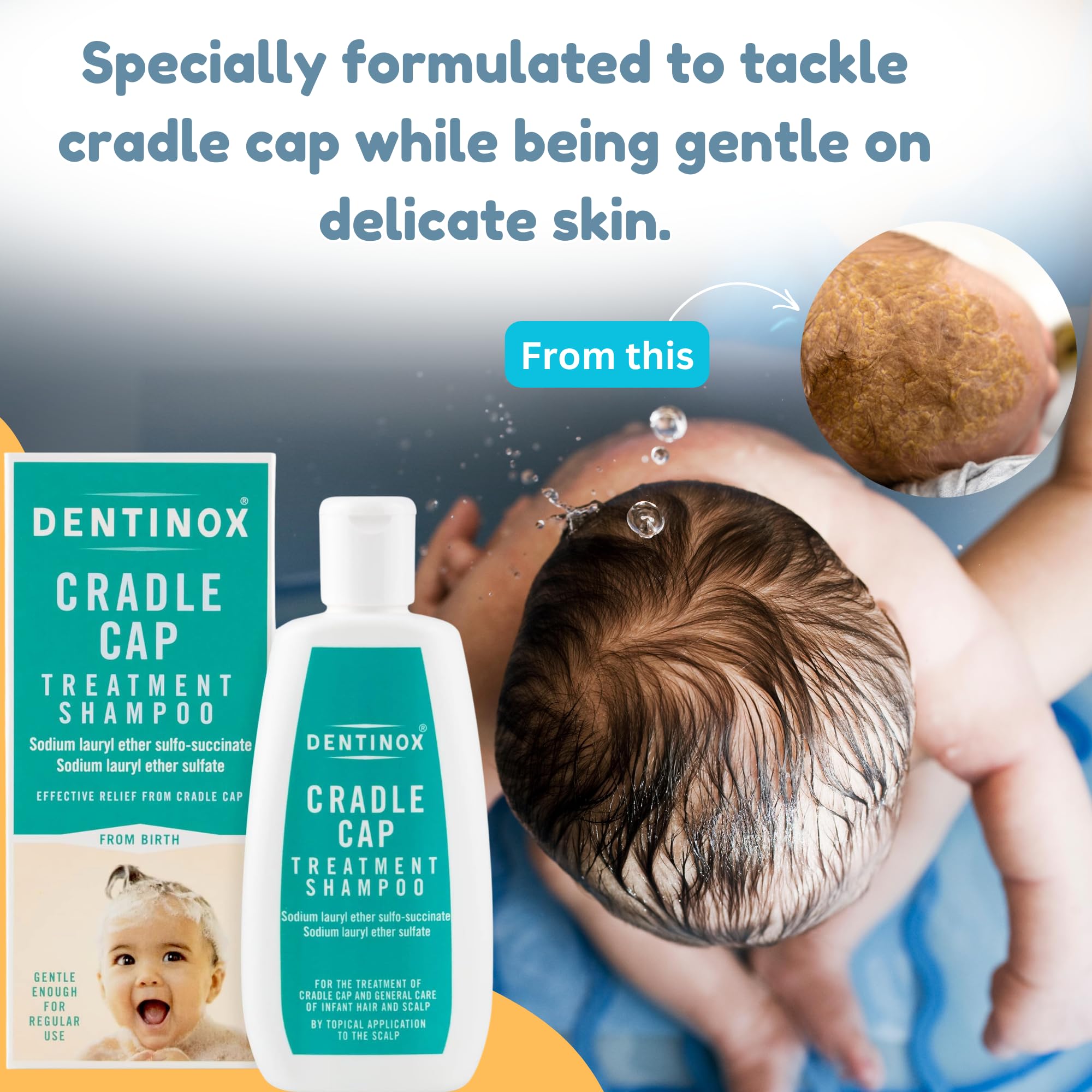 Dentinx Cradle Cap Shampoo 125ml with Nit Comb, Cradle Cap Treatment for Baby, Gentle Baby Bathing Products - Image 2