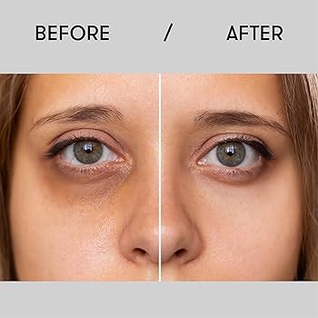 Amazon.com Sane Crema de ojos para ojeras y tratamiento de defecto con cafeína y niacinamida, 0.68 onzas líquidas, crema hidratante para ojeras, mañanas sin exagerado: Belleza y Cuidado Personal - Amazon.com