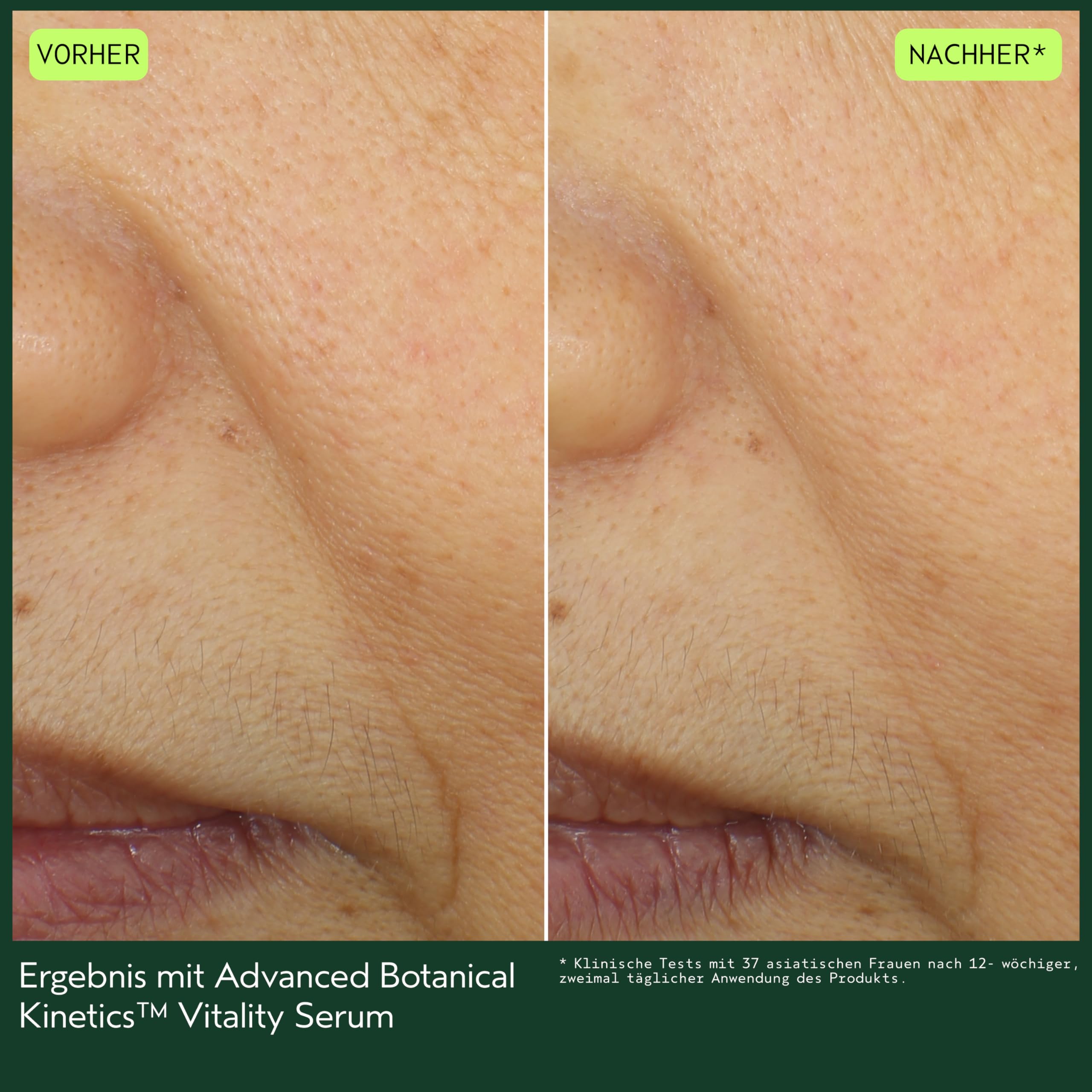 Aveda Botanical Kinetics™ Vitality Serum 30 ml | Anti-Aging Gesichtsserum | Mildert sichtbar feine Linien & Falten | Für alle Hauttypen