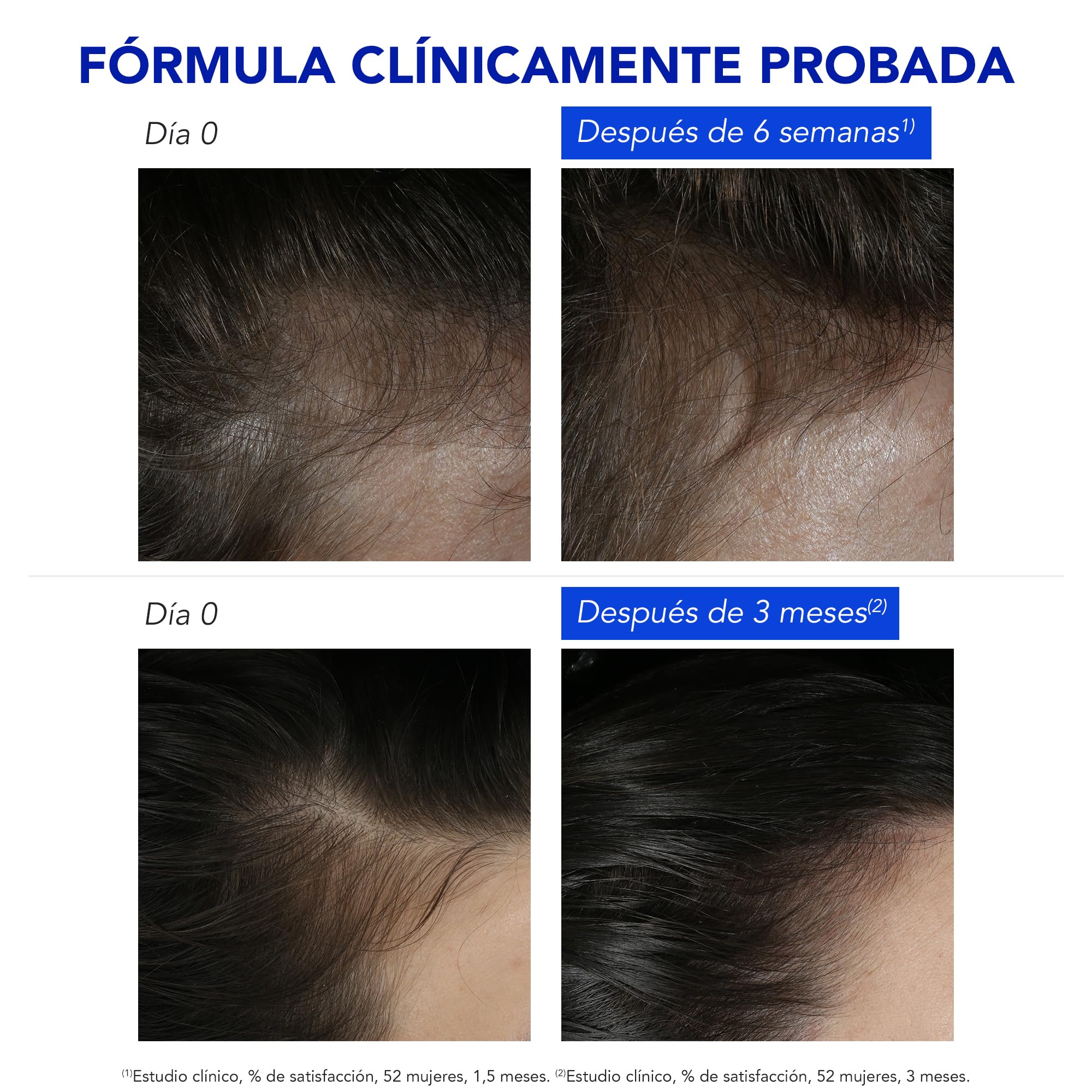 Phyto Paris - Phytophanère - Tratamiento Anticaída Reactiva 12 Ampollas x 5ml - Biotina - Zinc - Ácido Fólico - Frena la Caída por Estrés y Postparto