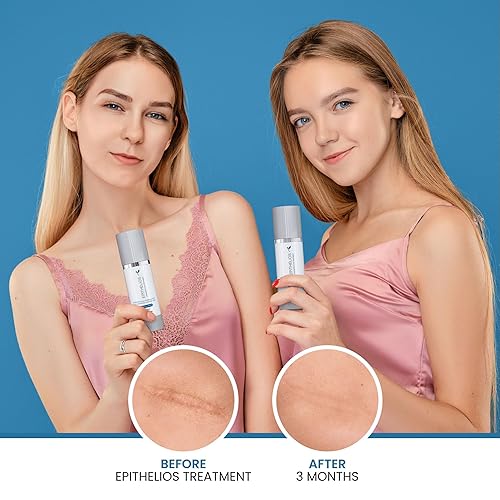 Miniatura 4 de Epithelios Tratamiento avanzado de cicatrices sin SPF  Compatible con maquillaje y cremas, gel de silicona autoadherente para cicatrices  hidratado,