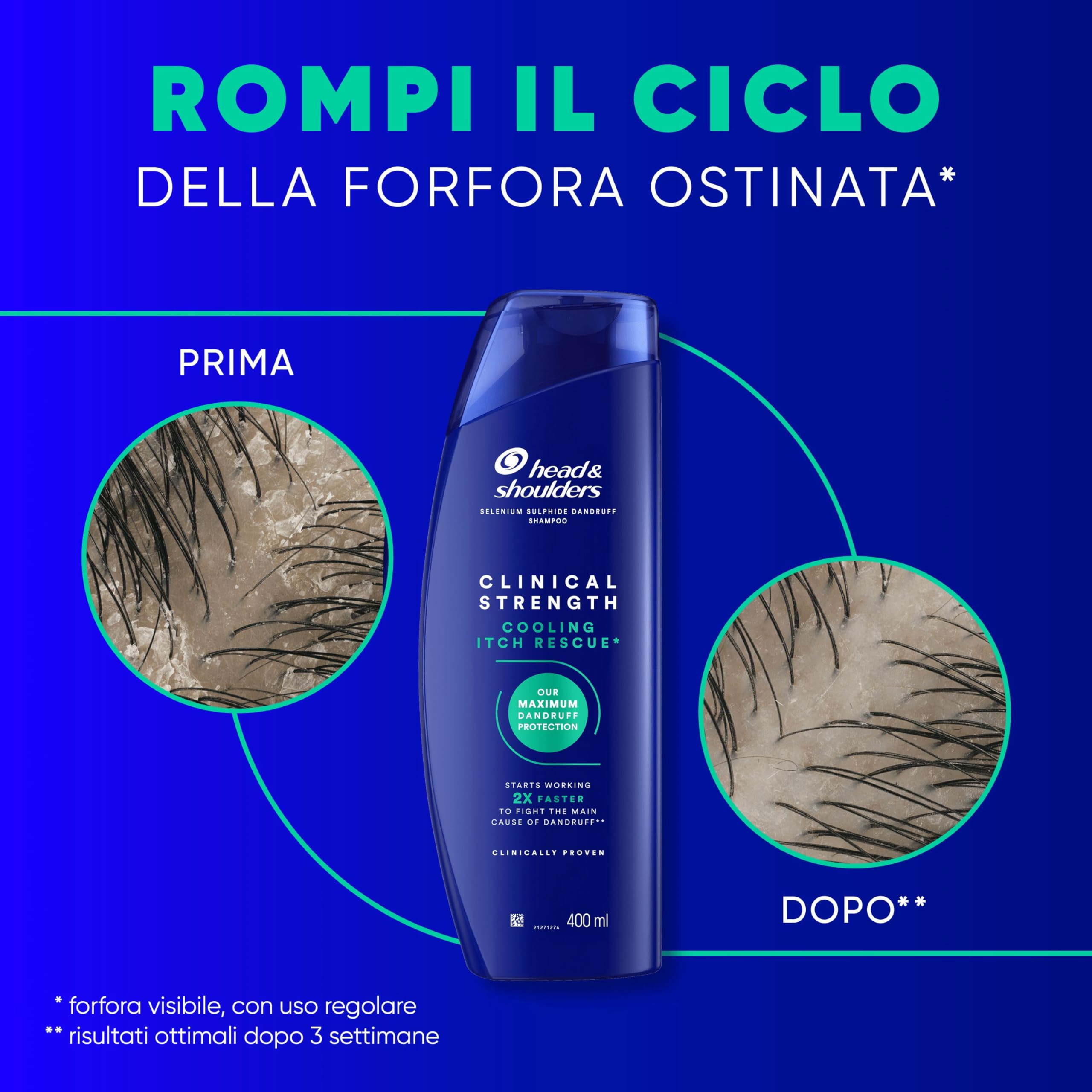 Head & Shoulders Clinical Strength Shampoo Antiforfora Antiprurito Cooling Itch Rescue al Solfuro di Selenio. Combatte la Forfora Ostinata e il Prurito, con Mentolo Rinfrescante Intenso, 400ml