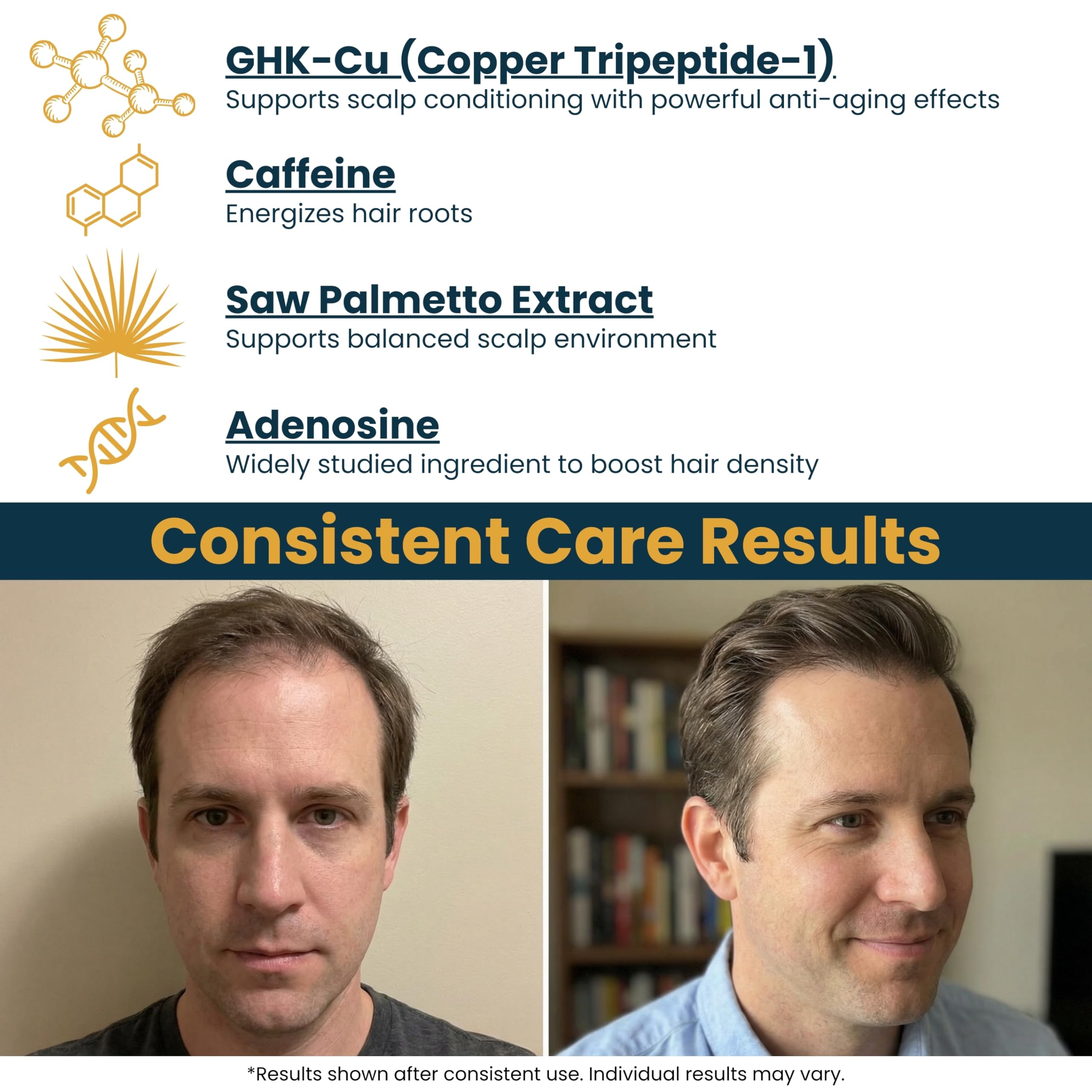 ghk cu results men Seraphime Copper Peptide Serum for Hair, 2% GHK-CU for Hair Growth, 1 floz Circulation Pump