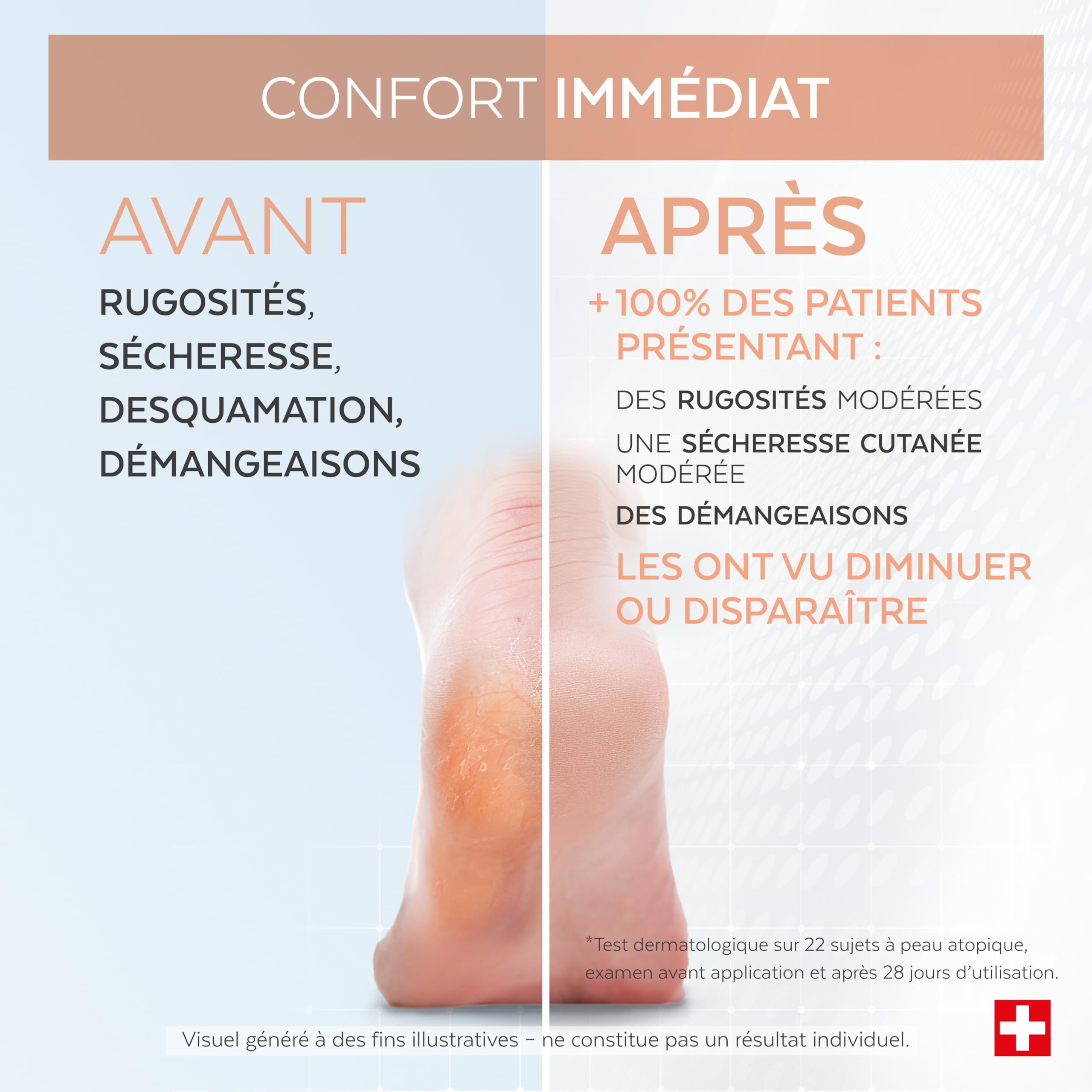 PODERM Sérum Mycose Pieds Athlète au Tea Tree | Répare et Apaise les Irritations, les Démangeaisons et la Desquamation | Post-Mycose, Psoriasis, Eczéma | Soin des Pieds | Fabriqué en Suisse.